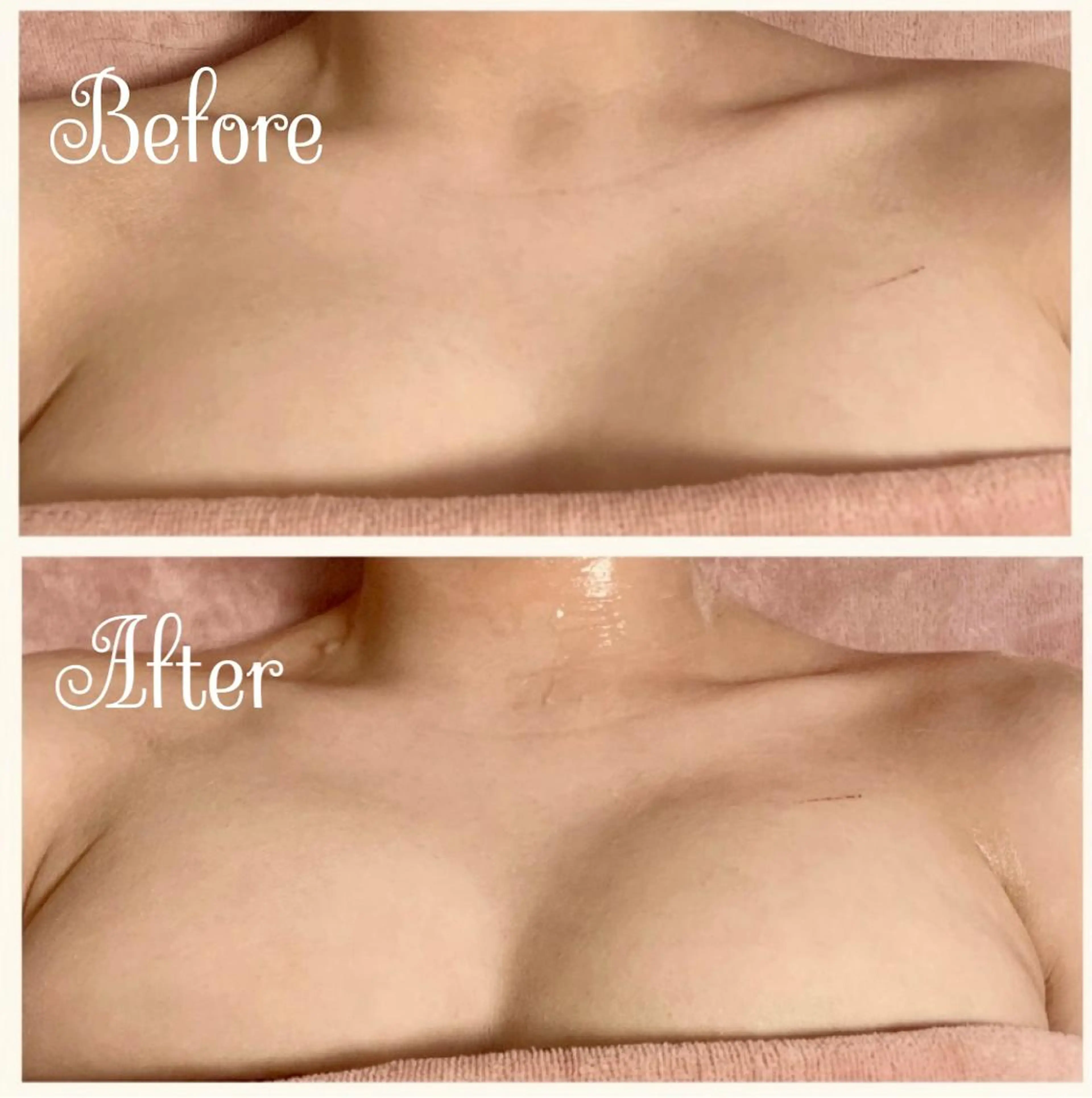 Linomalie エステ/たるみ/脱毛のエステ・リラクイメージ