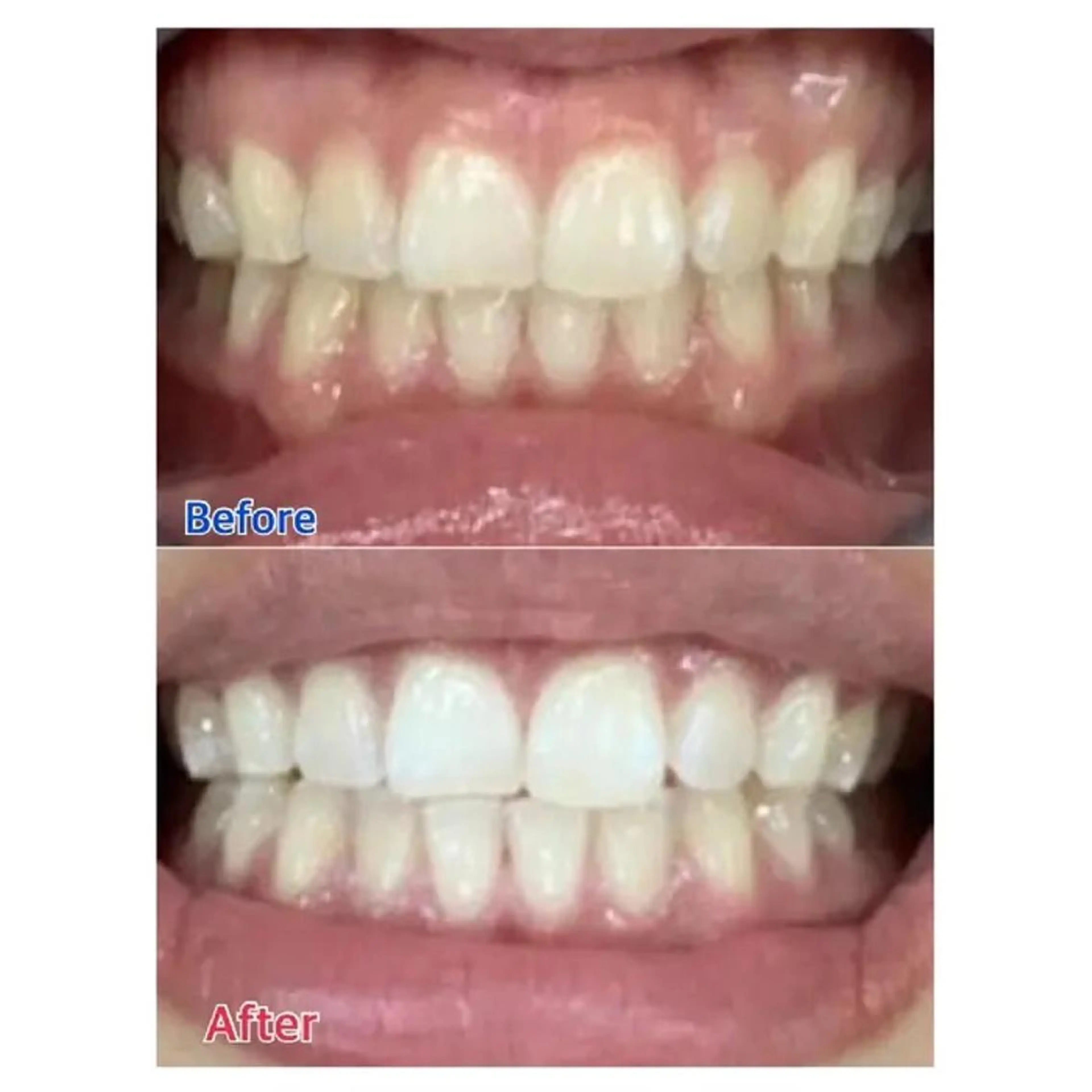 Ｍ渋谷 ホワイトニングのエステ・リラクイメージ