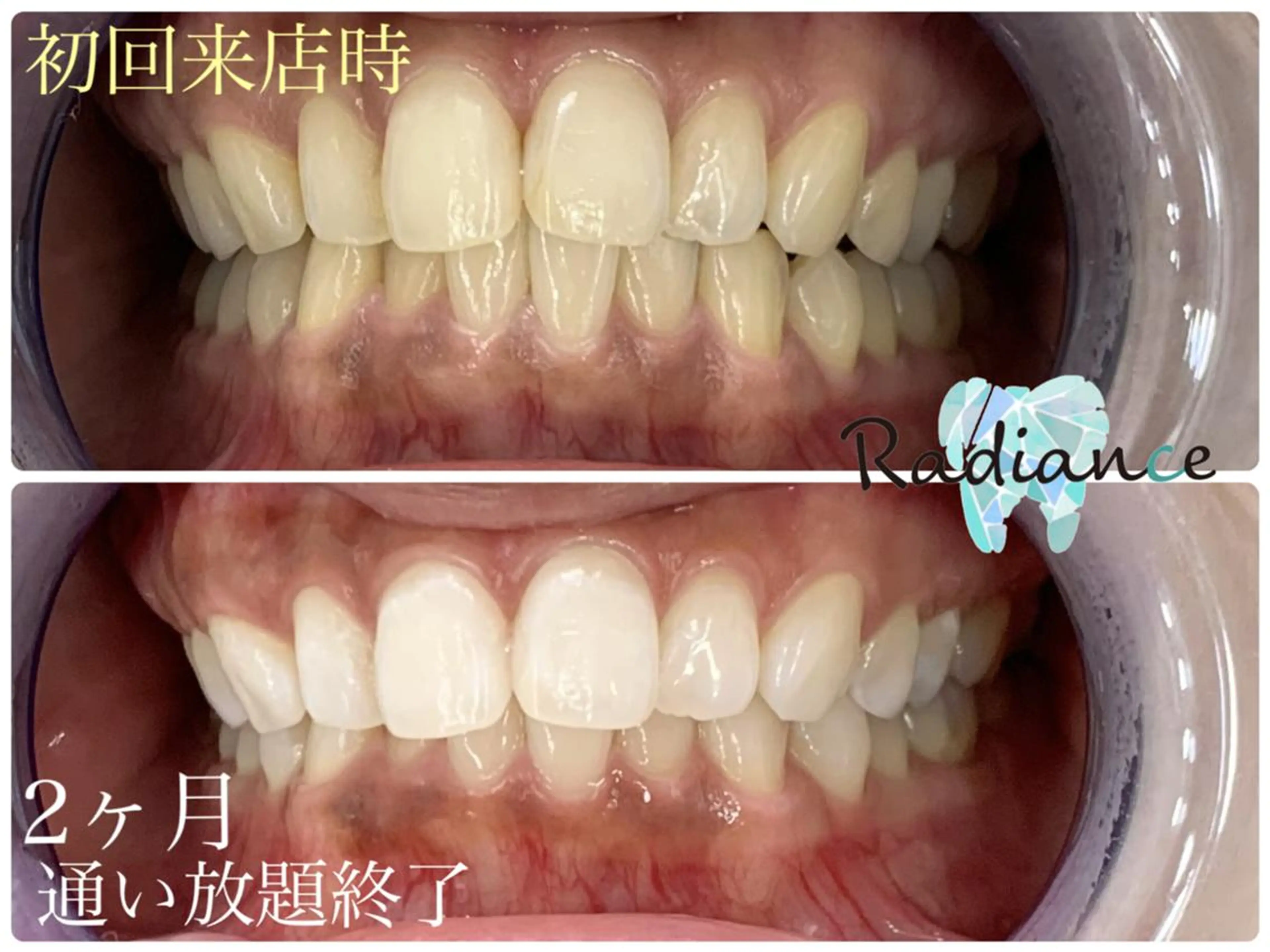 札幌ホワイトニング ラディアンス菊水店のその他イメージ