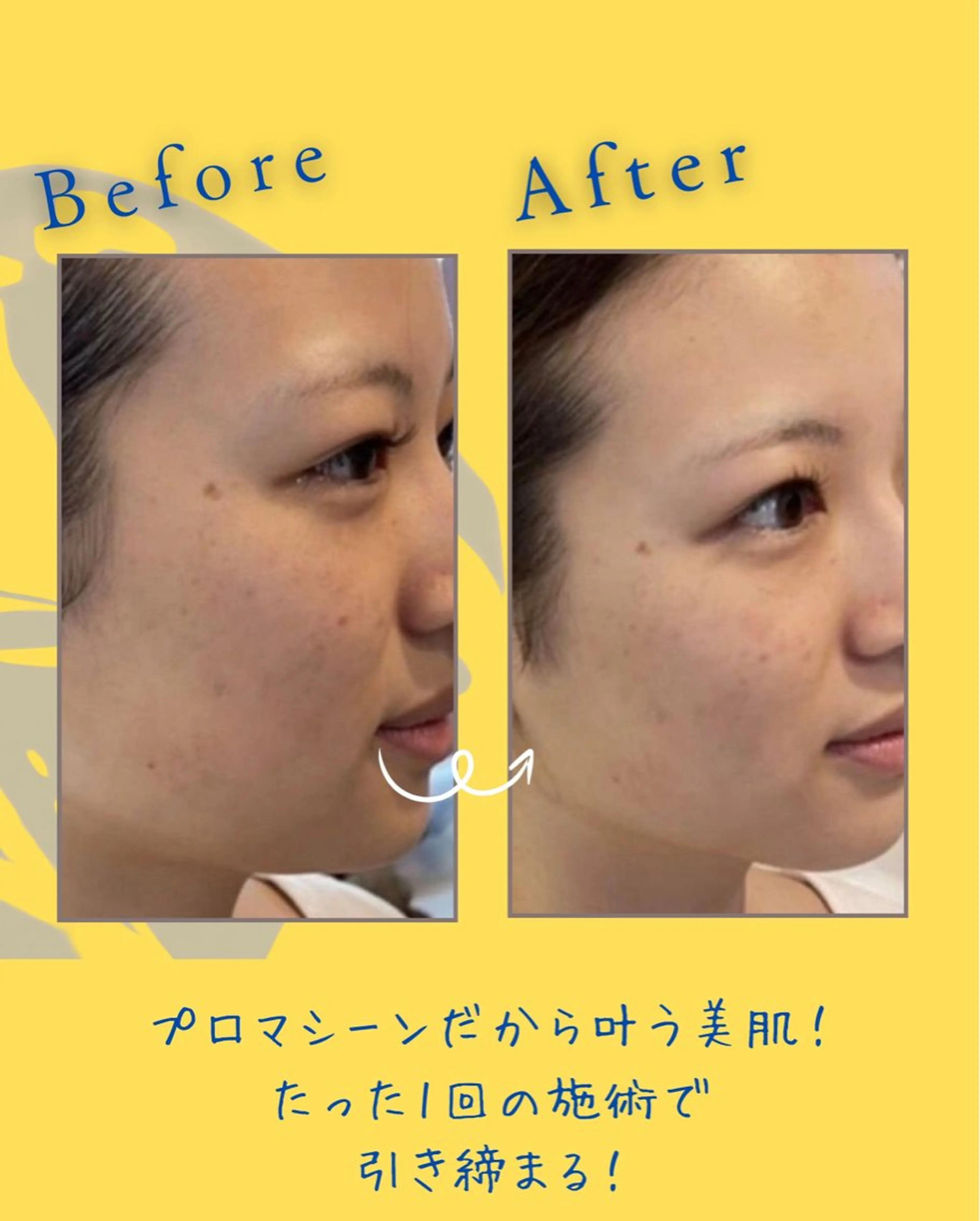 ヘアサロンLISALISA所属・セルフ脱毛・光エステ LISALISAのエステ・リラクイメージ