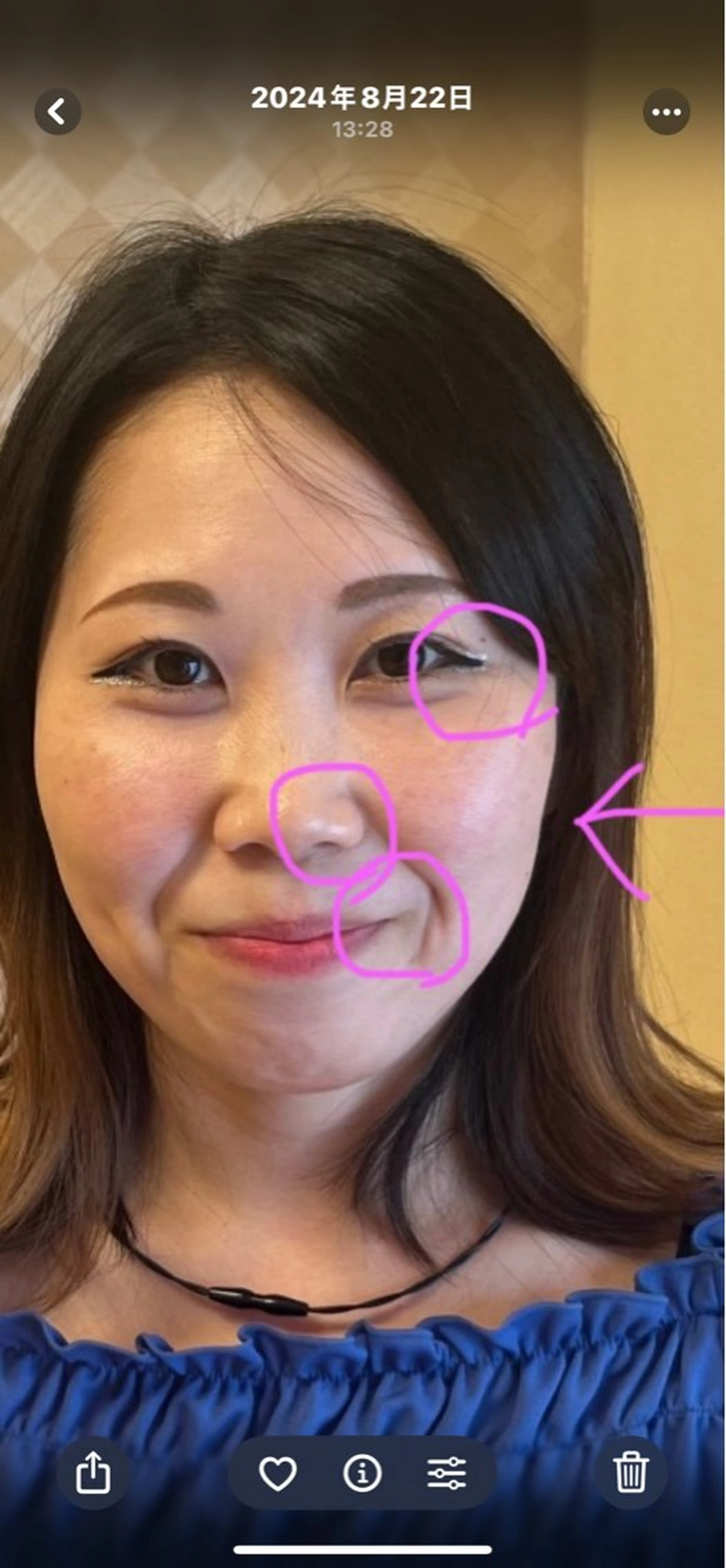 お顔のむくみスッキリ。リフトアップに、眼精疲労へのアプローチもできます。の写真