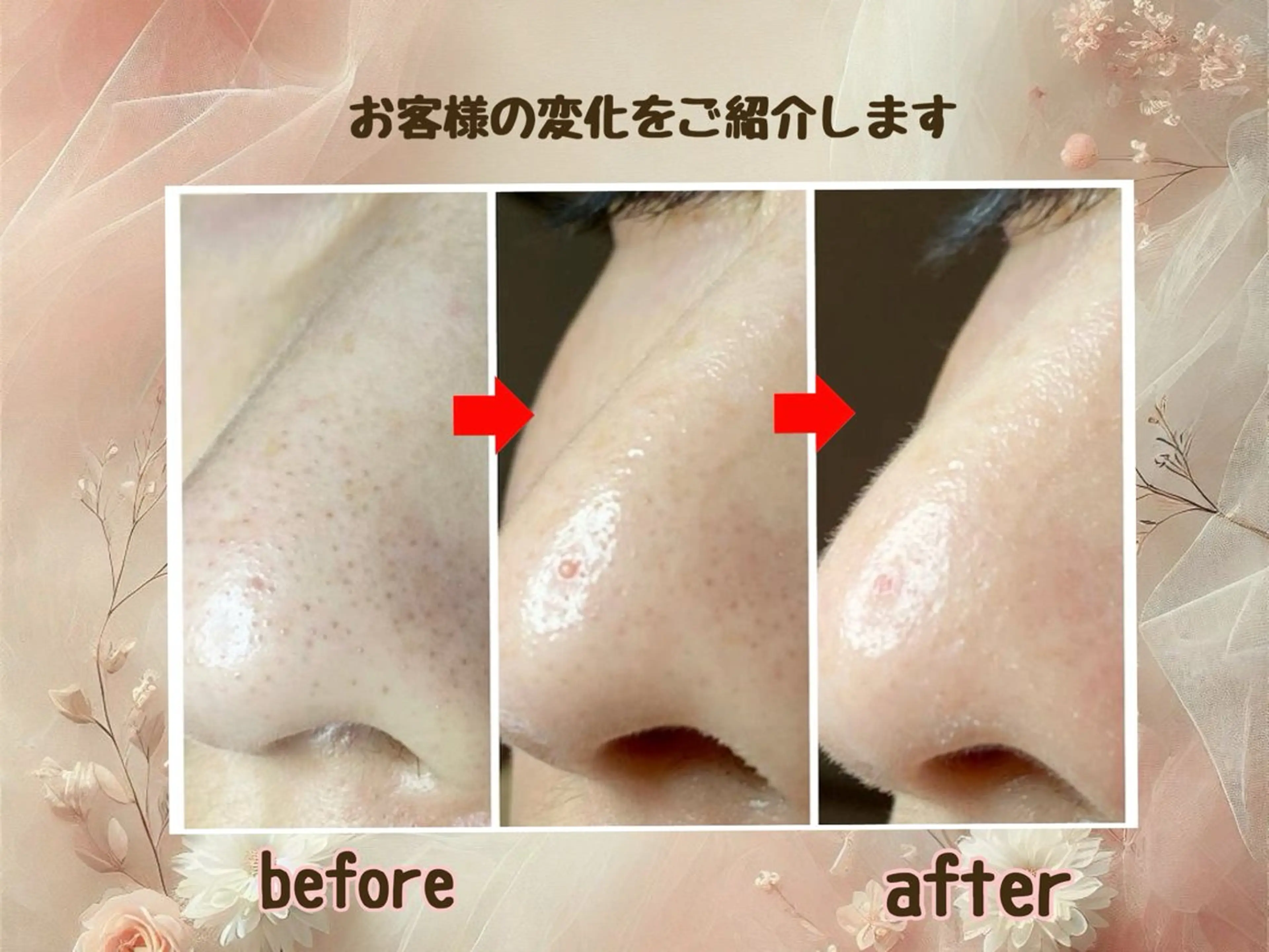 エステ 小顔矯正＆美肌サロン ブプラ大元駅前店のエステ・リラクイメージ