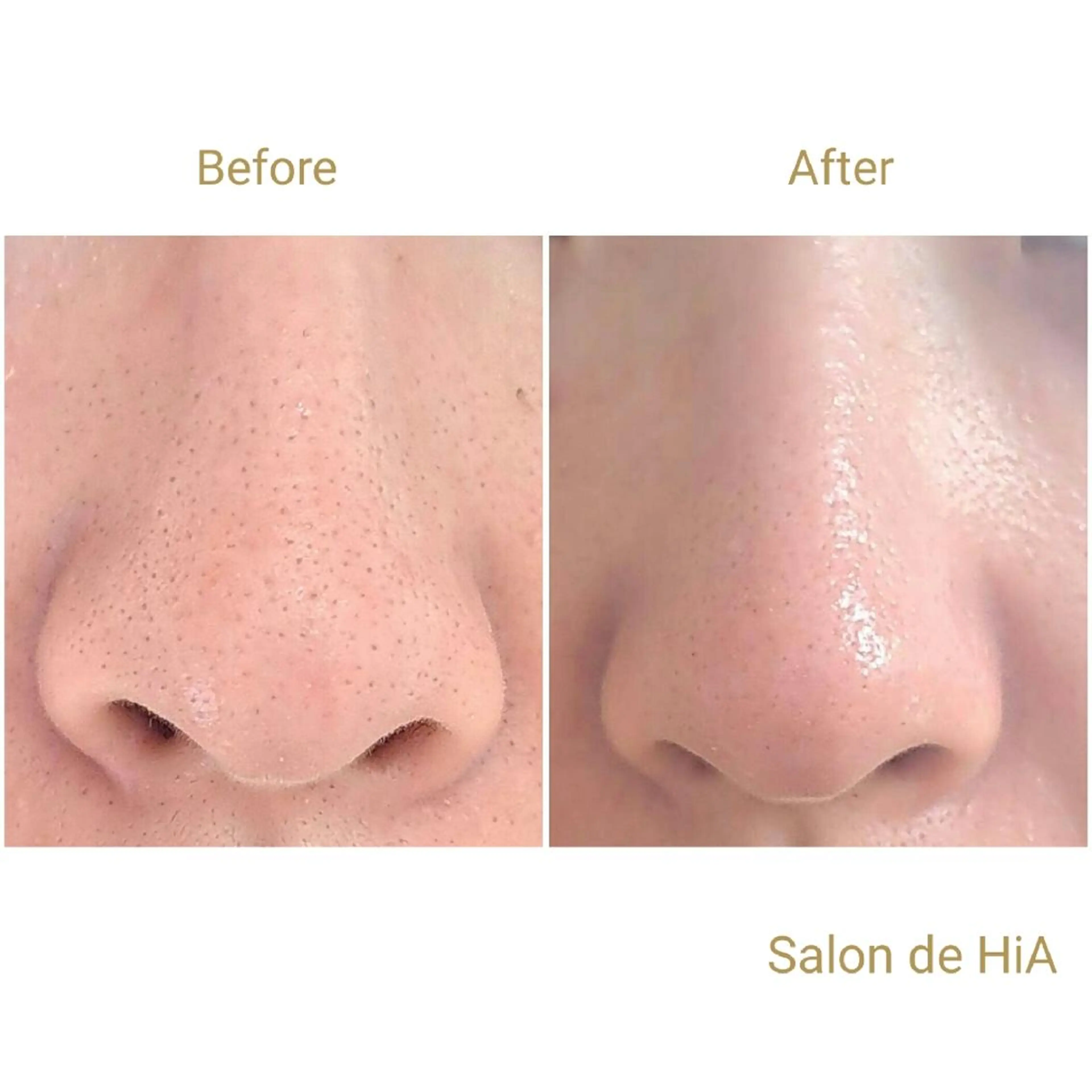 エステ Salon de  HiAのエステ・リラクイメージ