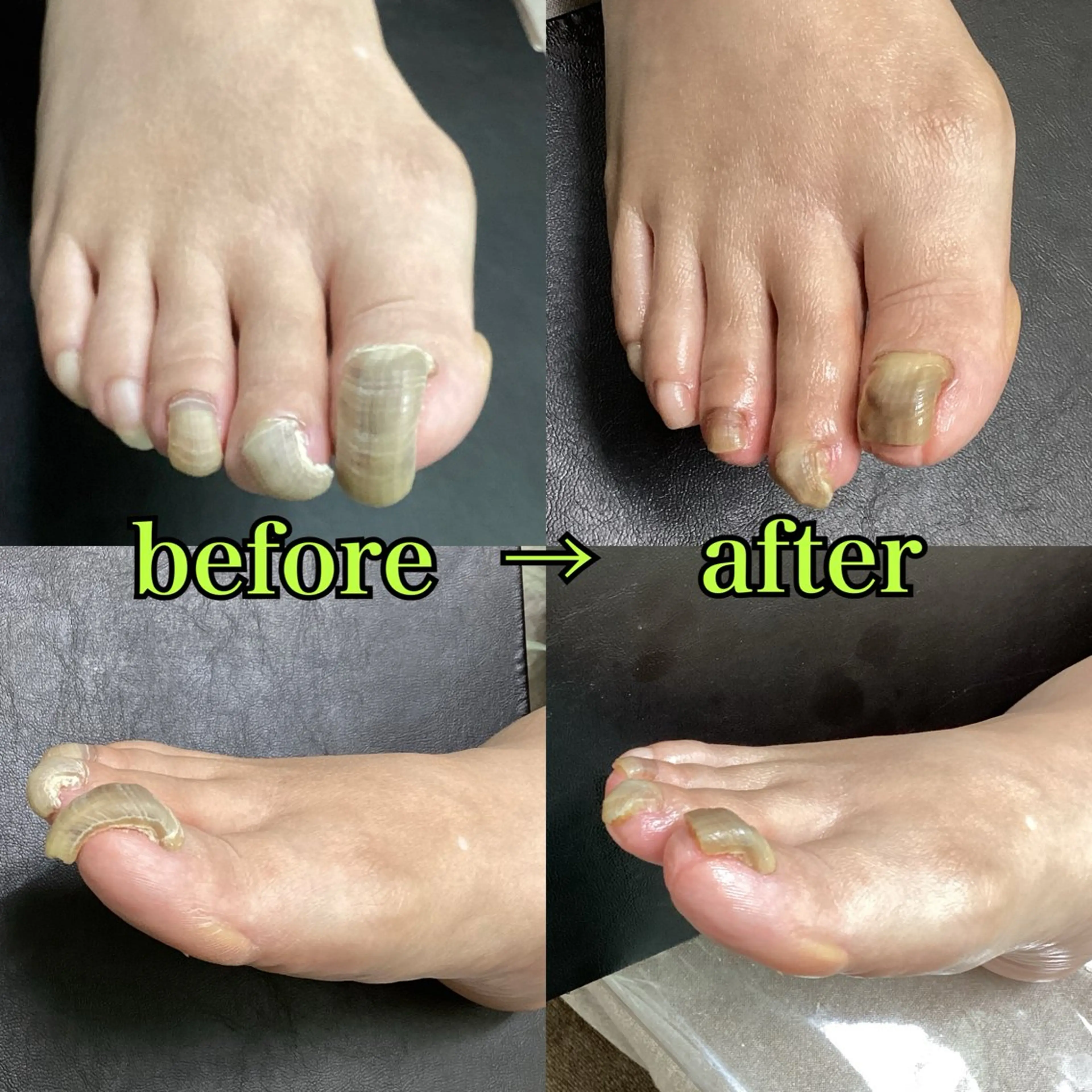 フットネイル リラク/ネイル/ 足裏ケア/蛭川栞のエステ・リラクイメージ