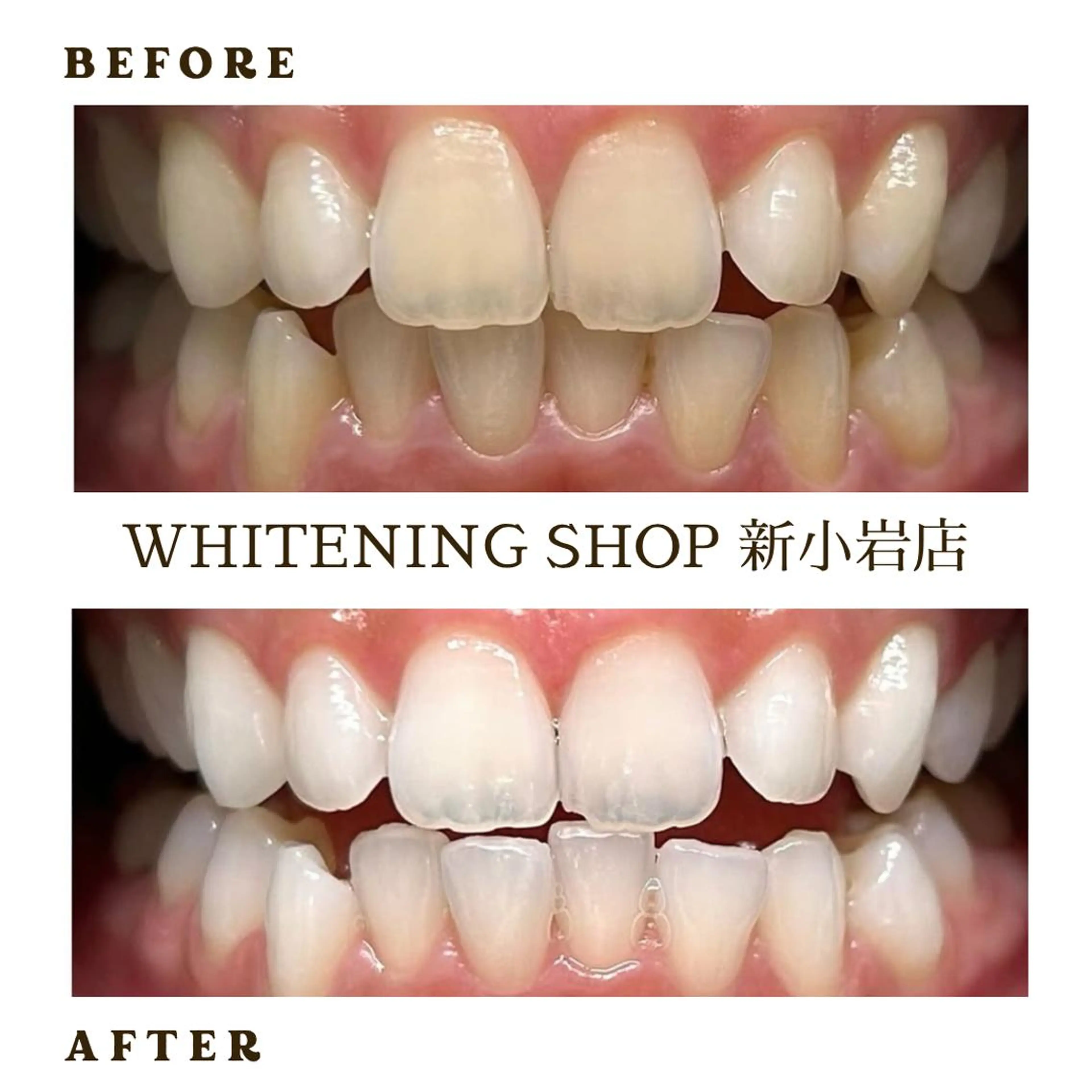 メンズ その他 ホワイトニング ショップ新小岩店のその他イメージ