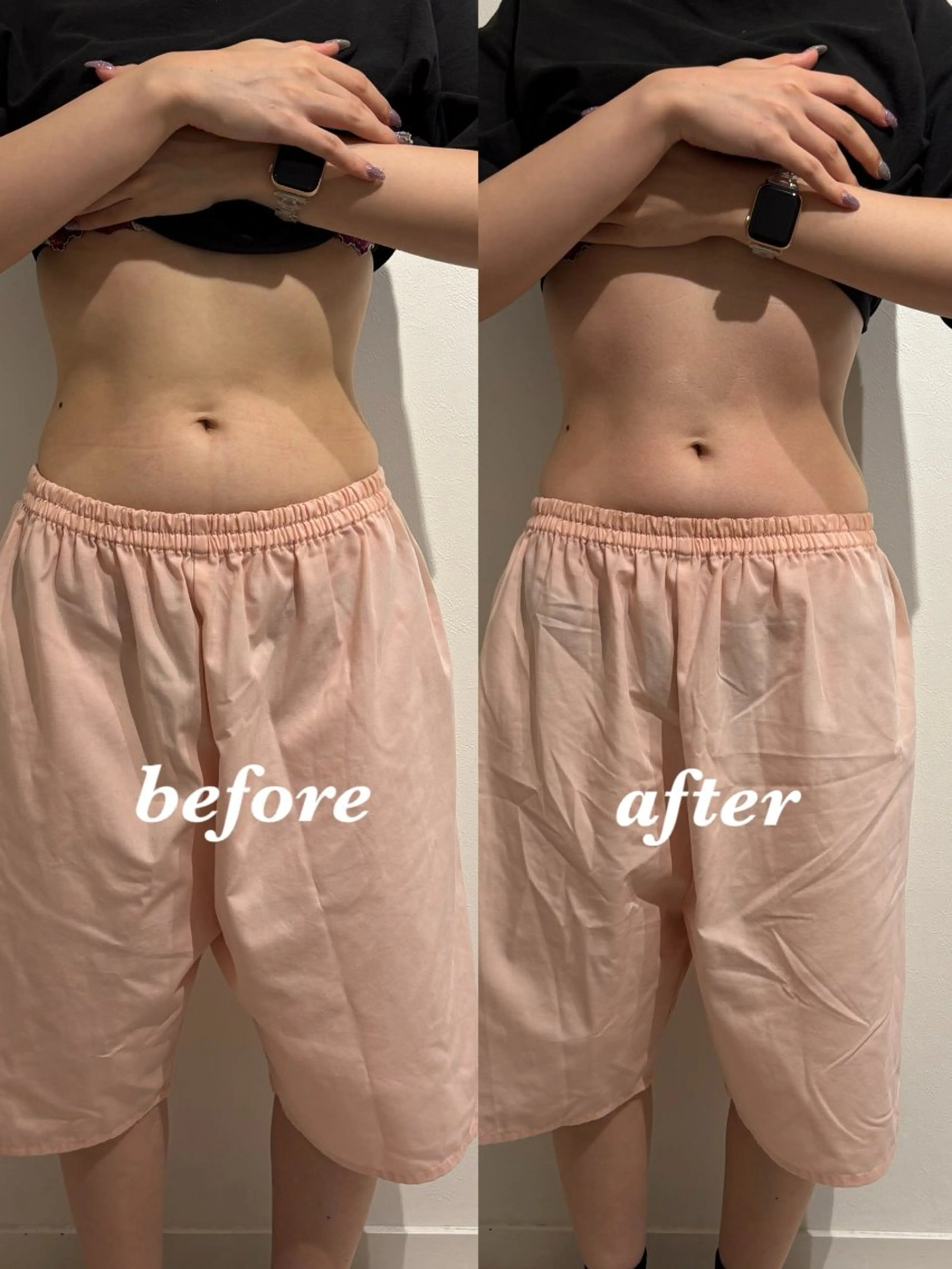 エステ リラク 腸活サポート みなみののエステ・リラクイメージ