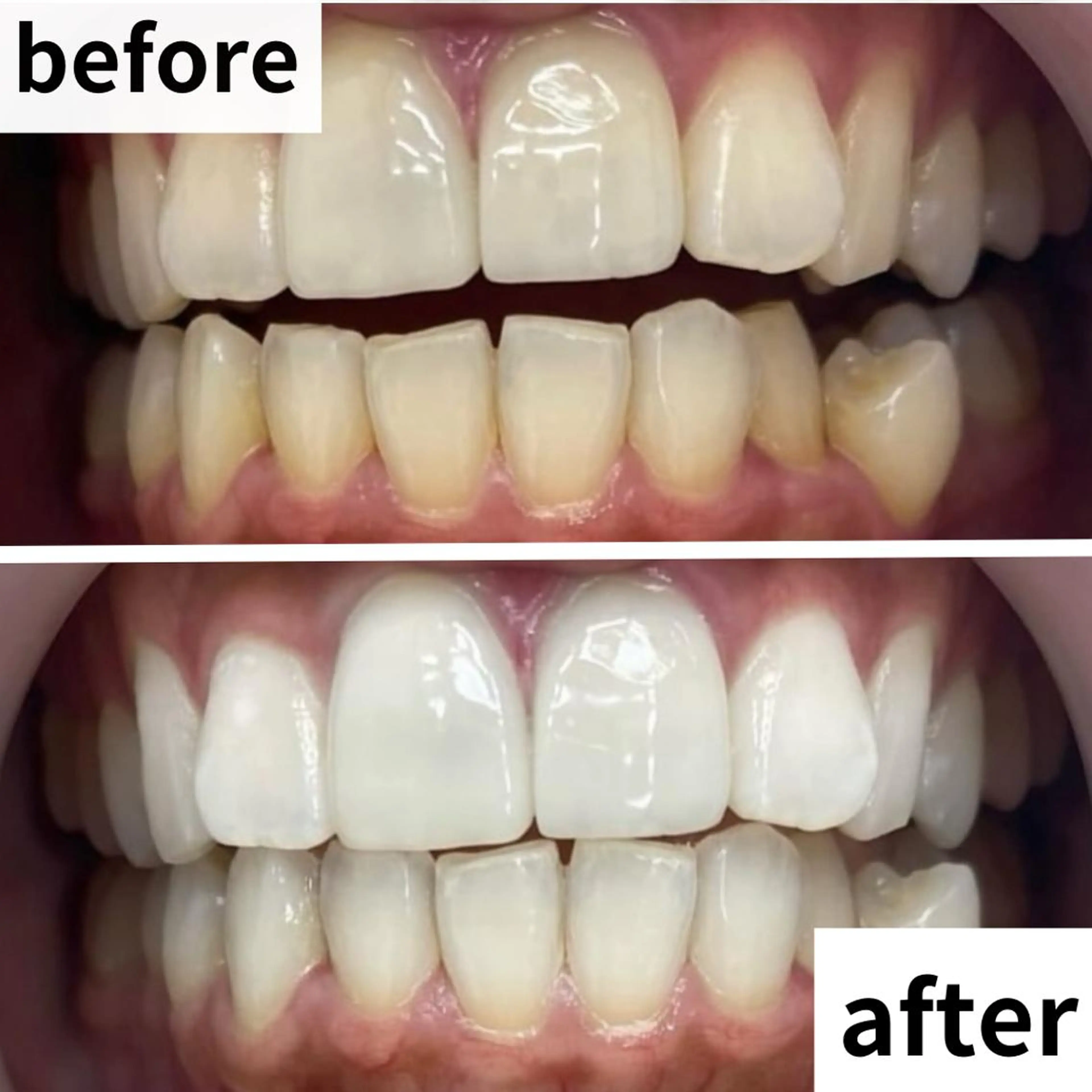 LBSホワイトニング 🌐渋谷店 河内のエステ・リラクイメージ