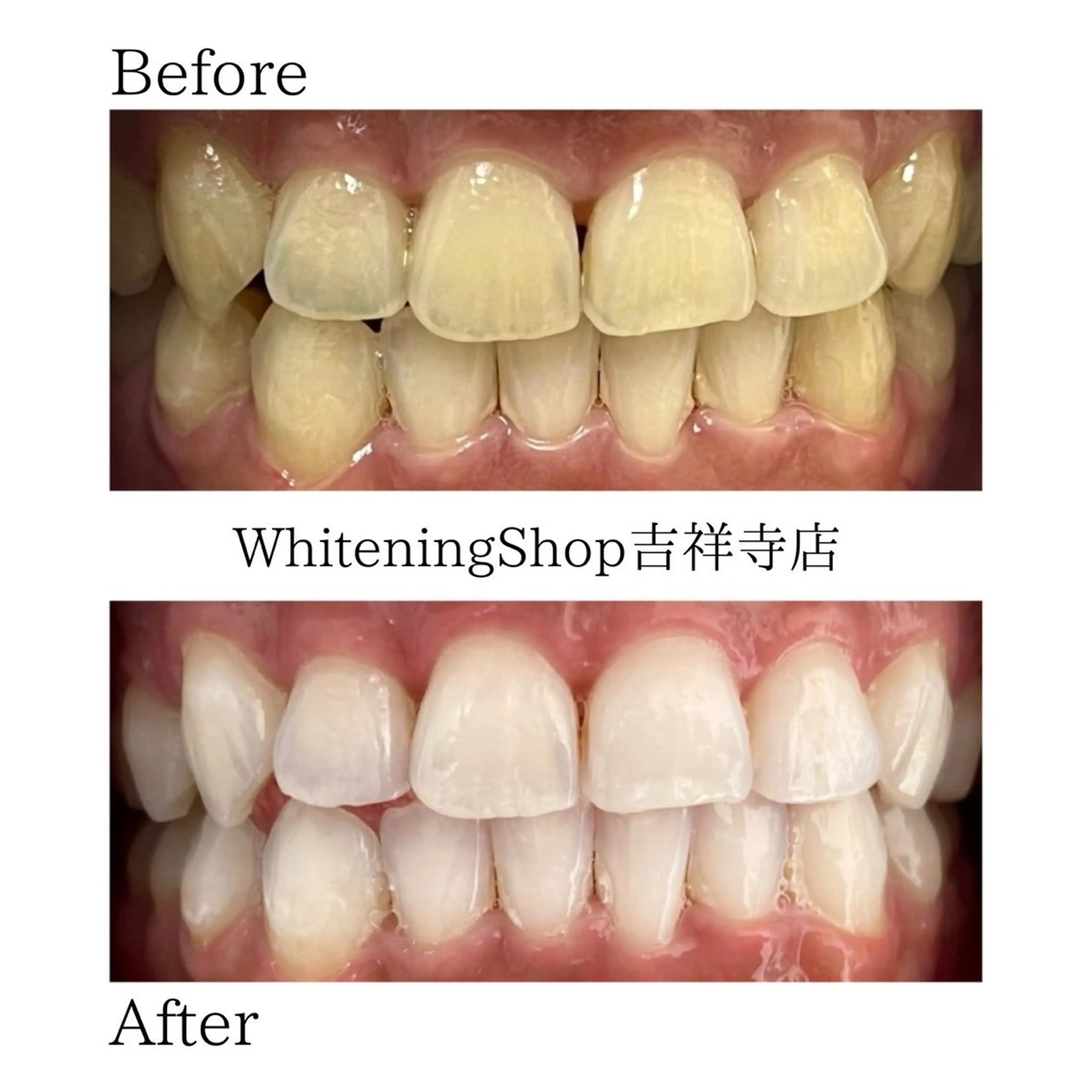 ホワイトニング ショップ吉祥寺店のエステ・リラクイメージ