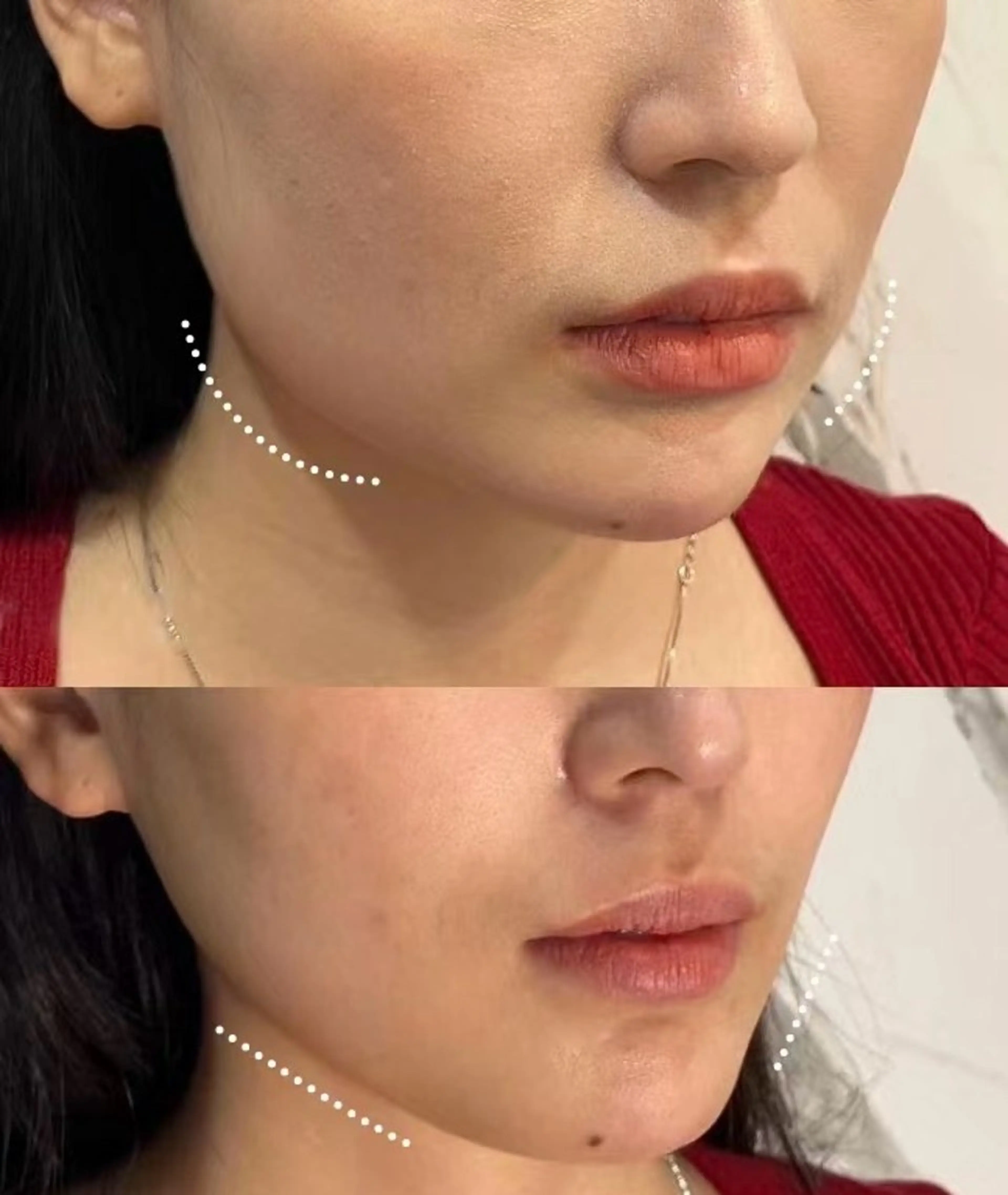 マツエク・マツパ エステ aliaハイフ&水光ジェットサロン所属・aliaハーブ水光店 エステティシャン募集のエステ・リラクイメージ