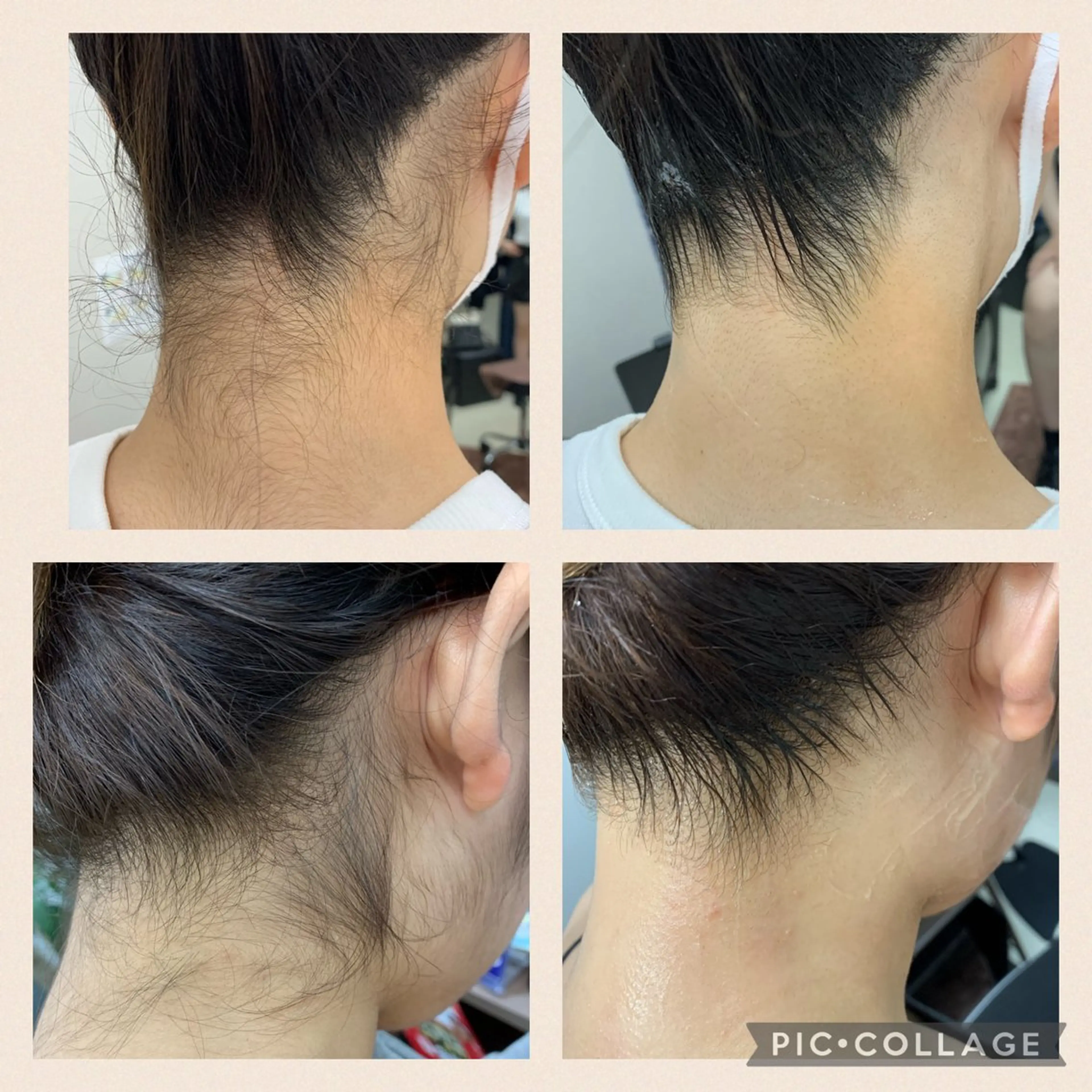 脱毛 キングスサロン長崎佐世保店所属・キングスサロン 長崎佐世保店のエステ・リラクイメージ