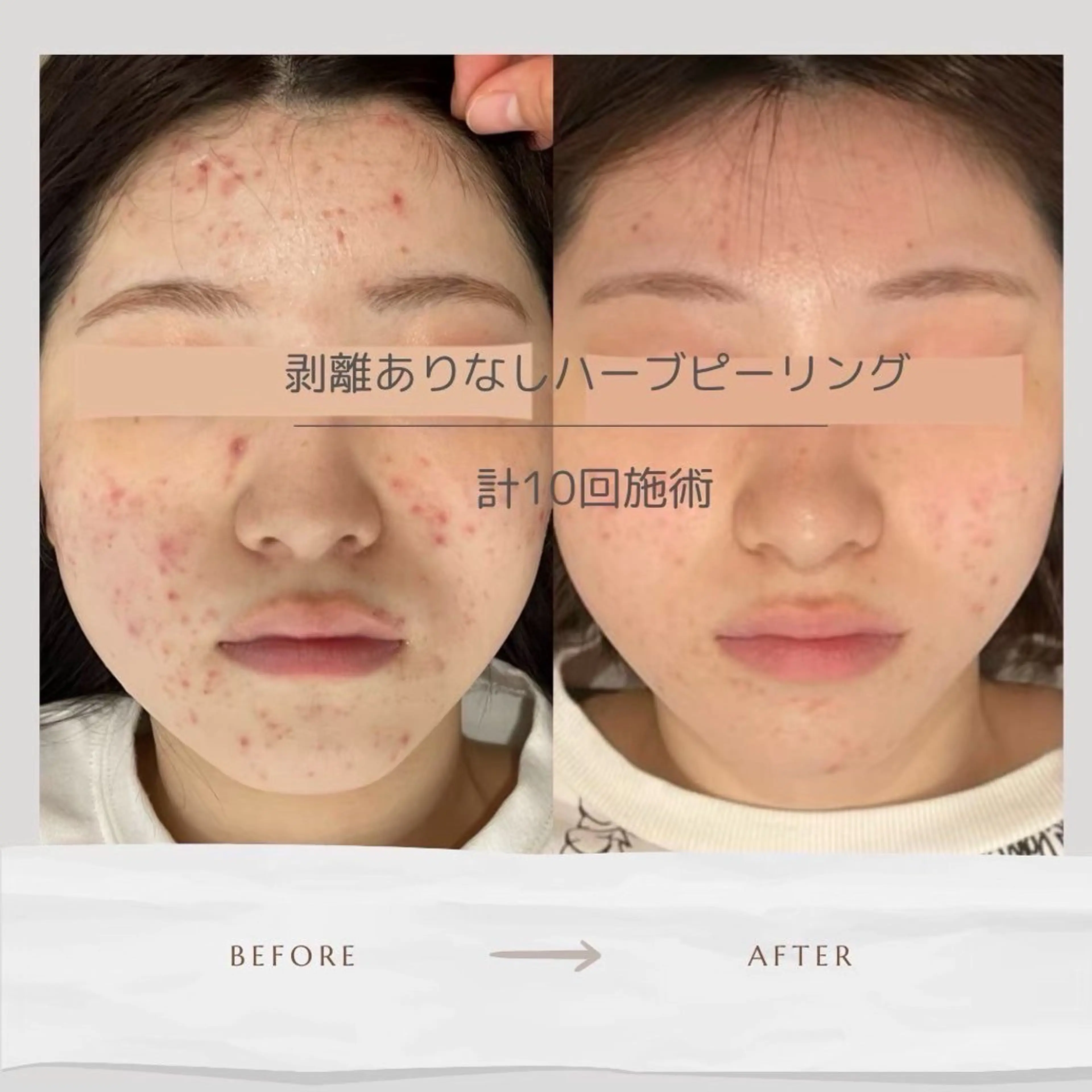 Life Salon別府店のエステ・リラクイメージ