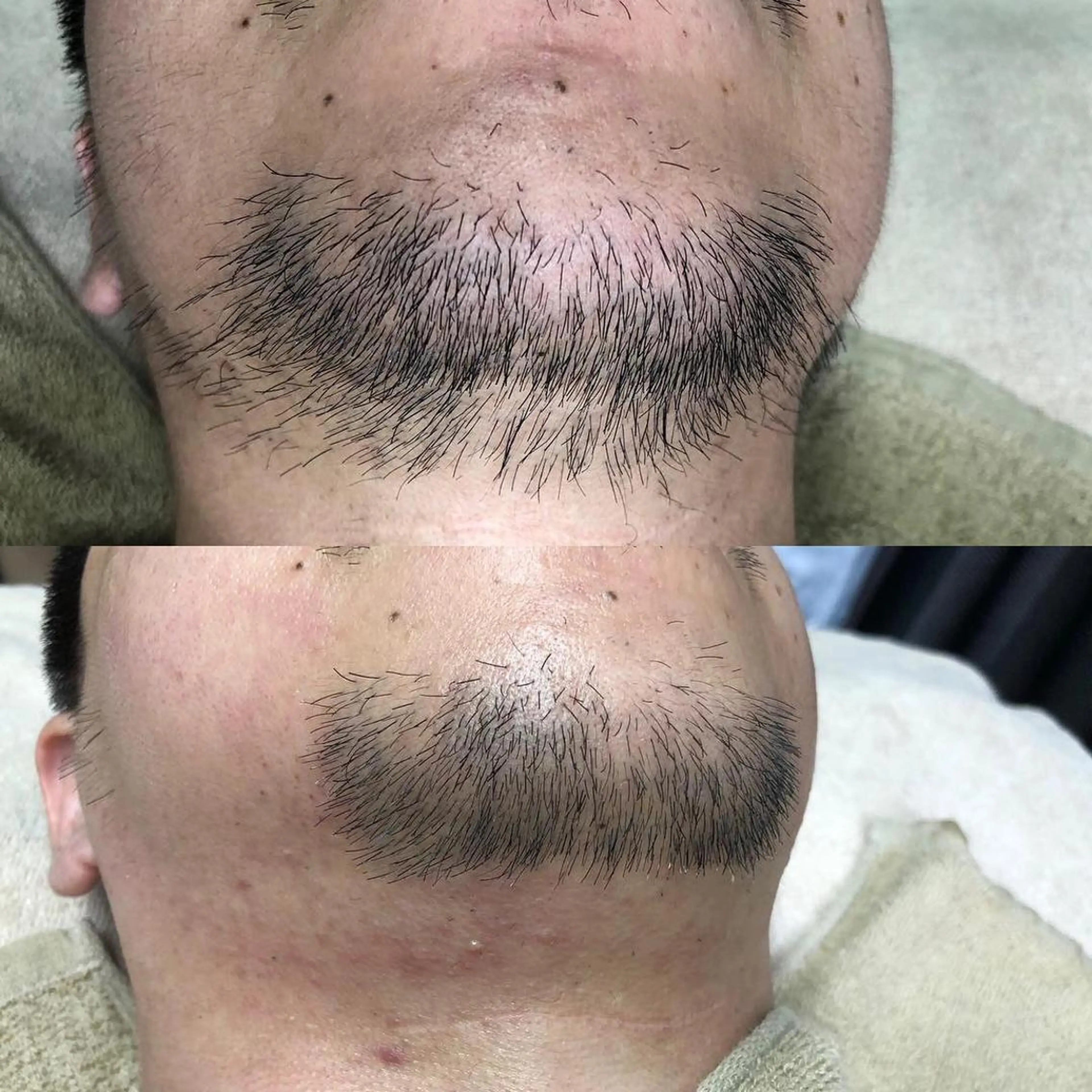 メンズ BRUSH  BODY所属・男性施術者による 光脱毛×ワックス脱毛のエステ・リラクイメージ