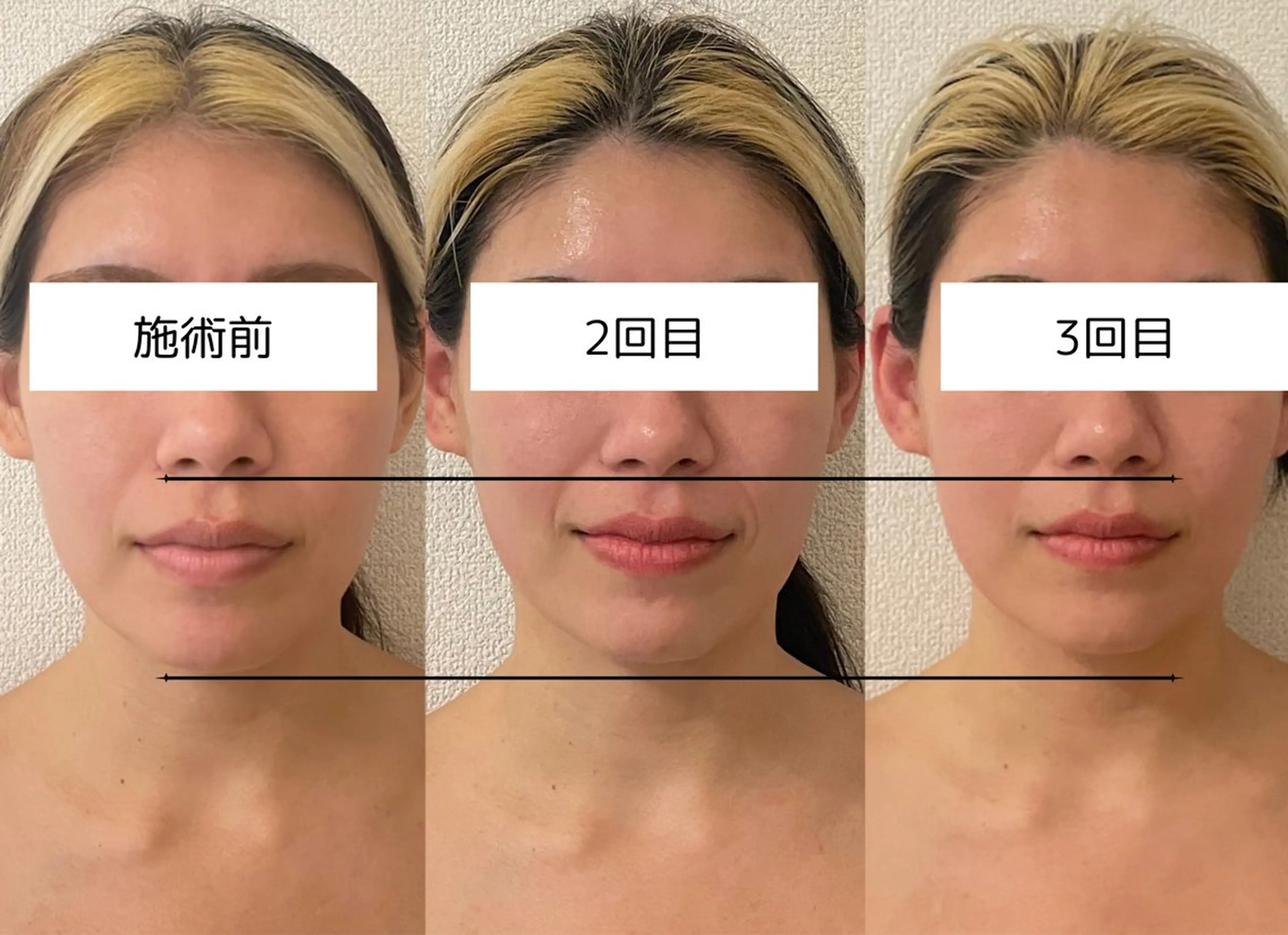 エステ 【小顔痩身専門看護師 サロンSONA】のエステ・リラクイメージ