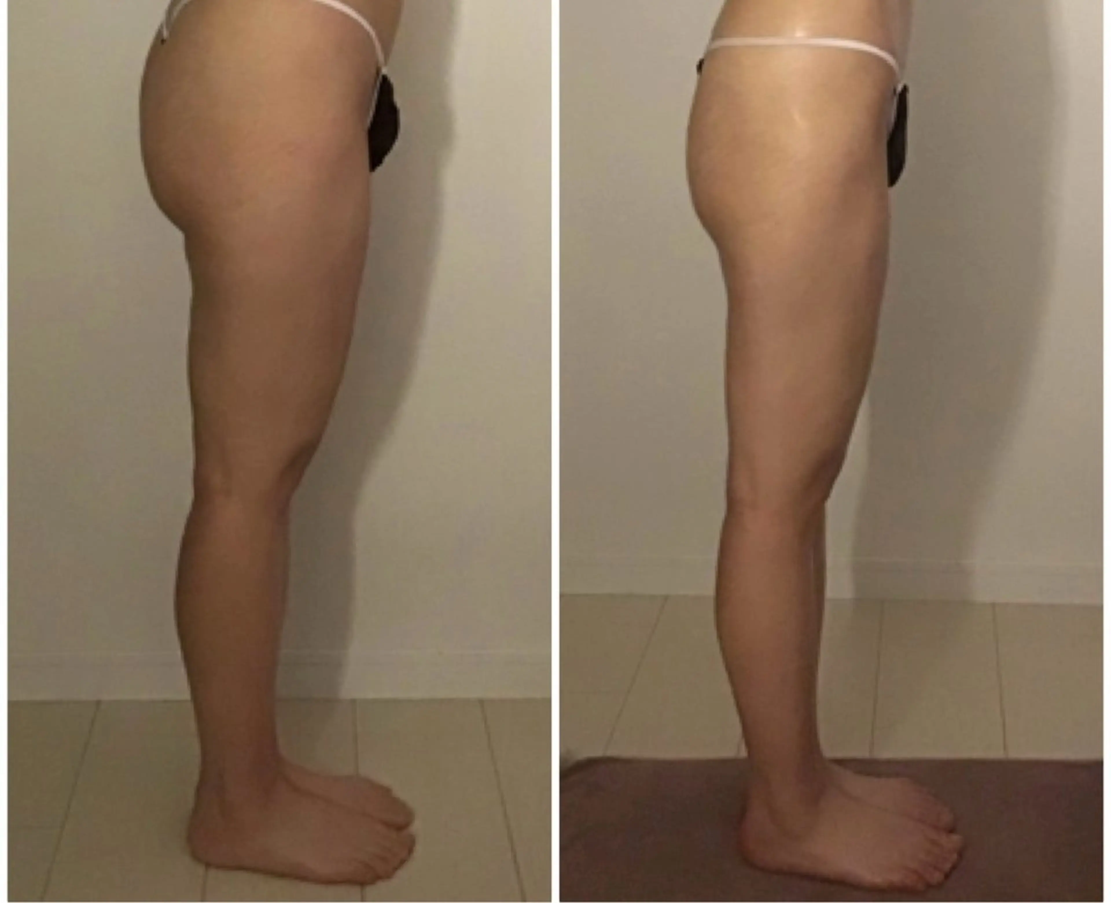 BELLEFINE 💕痩身・小顔・脱毛のエステ・リラクイメージ