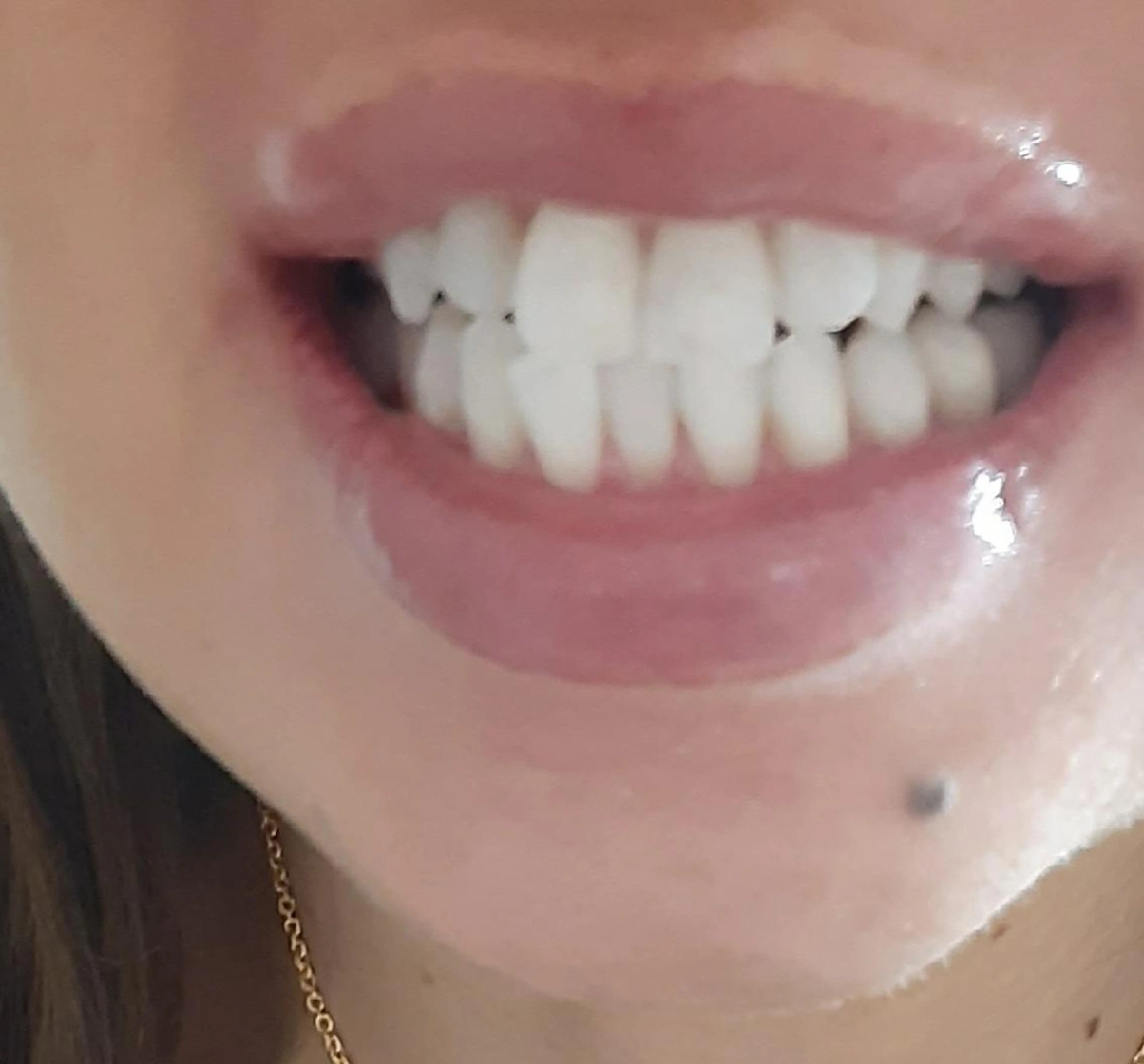 その他 五十嵐 蓮のその他イメージ