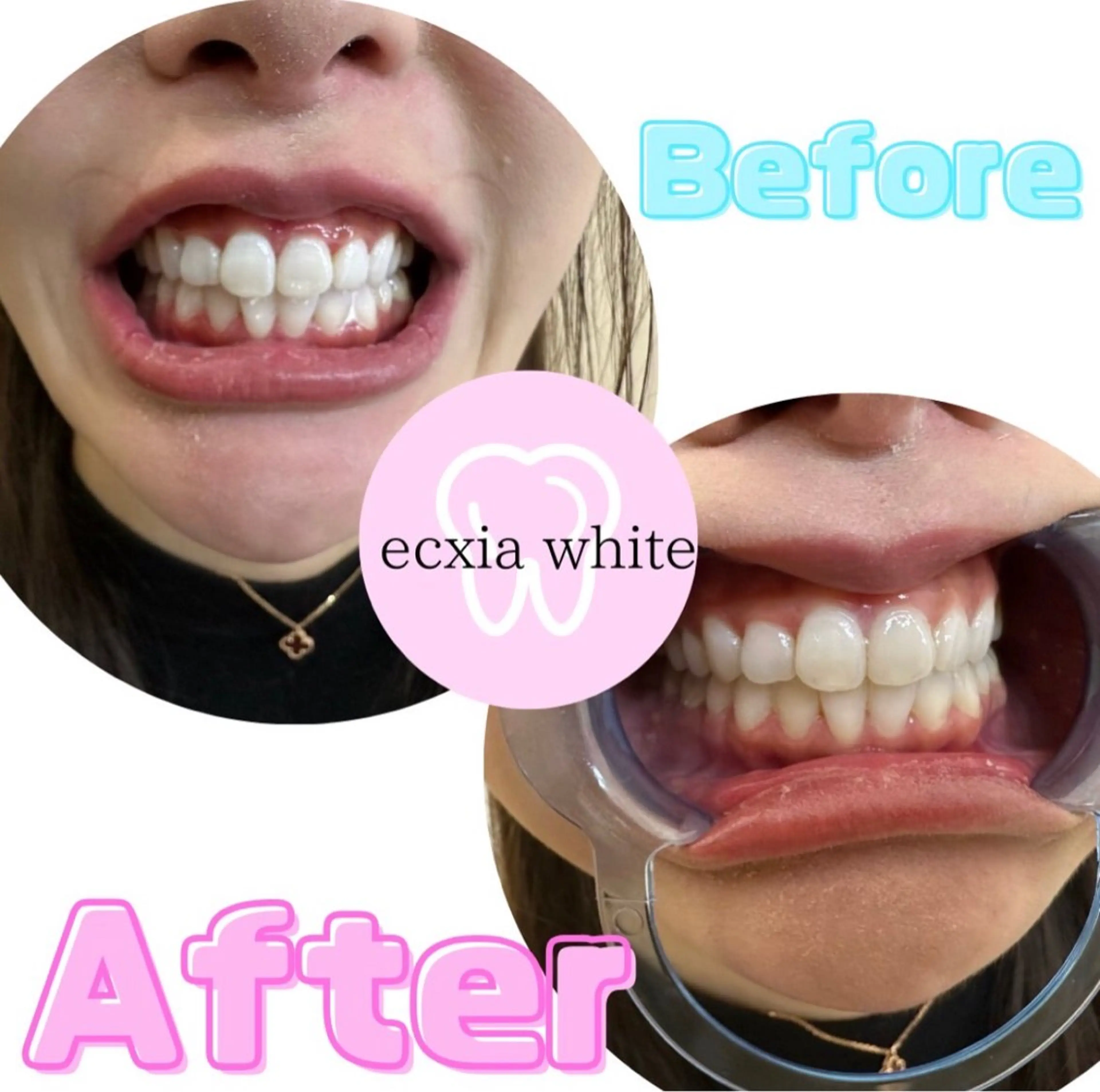 エクシア ホワイトニング西条店のその他イメージ