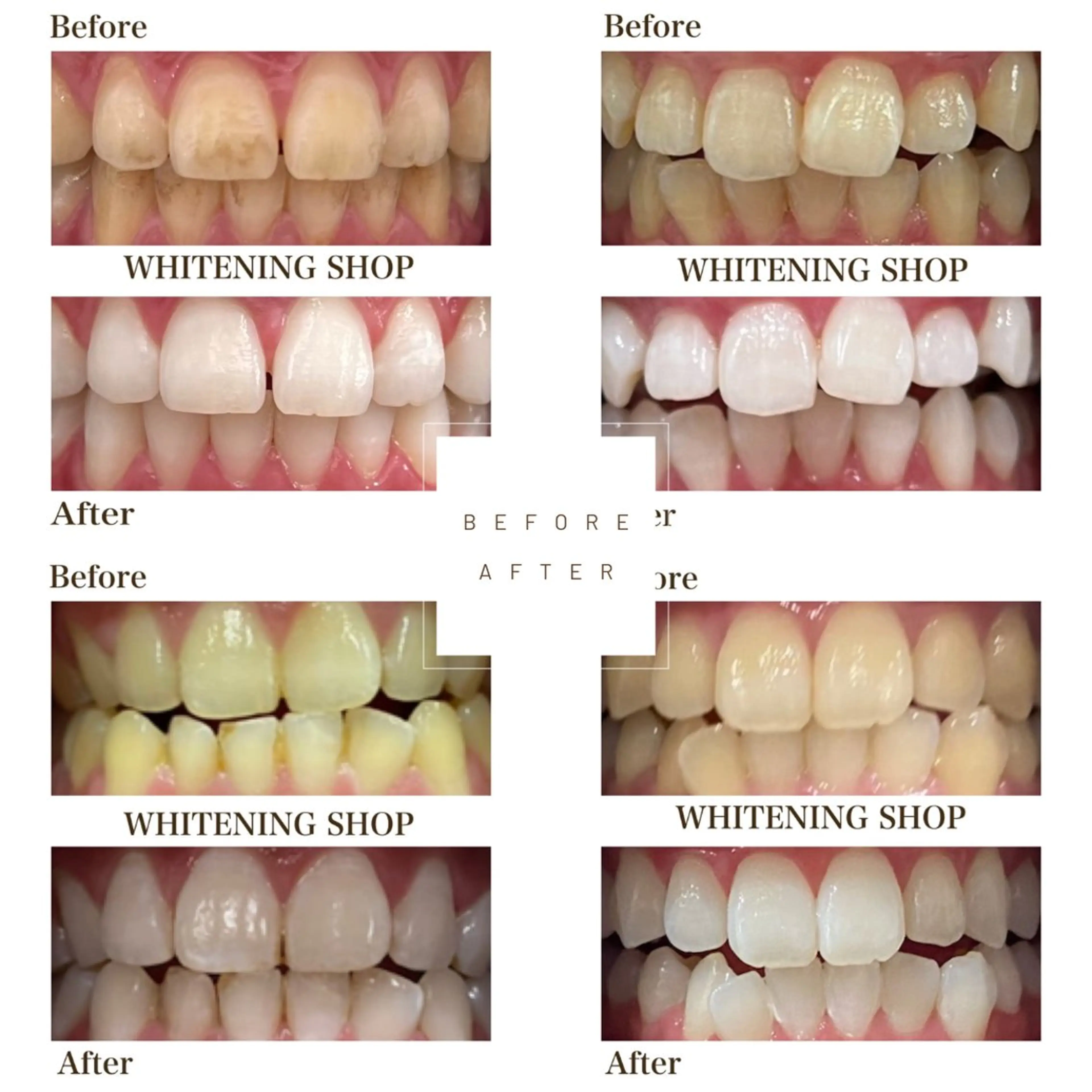 ホワイトニング ショップ伊丹店のその他イメージ