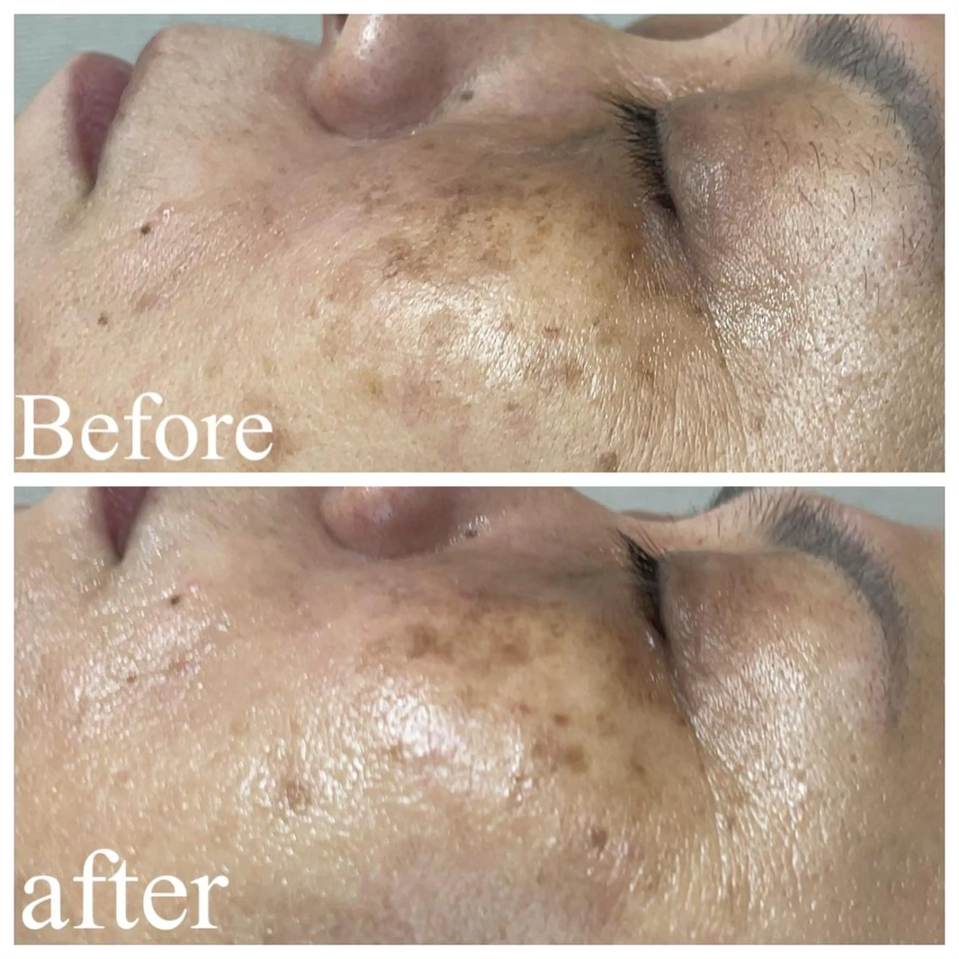 肌質改善サロン facialmoonのエステ・リラクイメージ