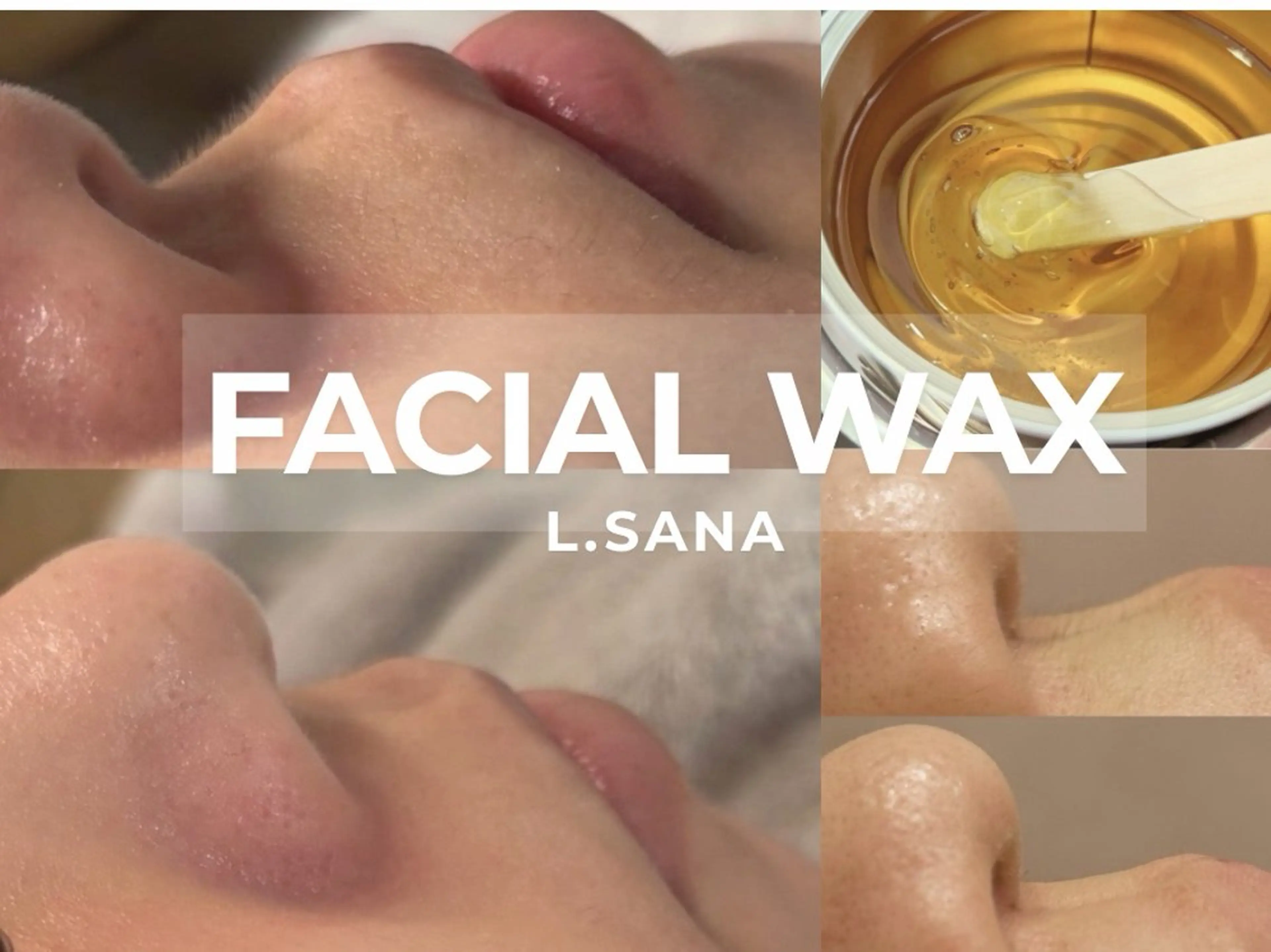 【人気No.1】垢抜け／全顔フェイスワックス➕小顔矯正💫　産毛角質OFF小顔フェイスラインスッキリ一度で効果◎の写真