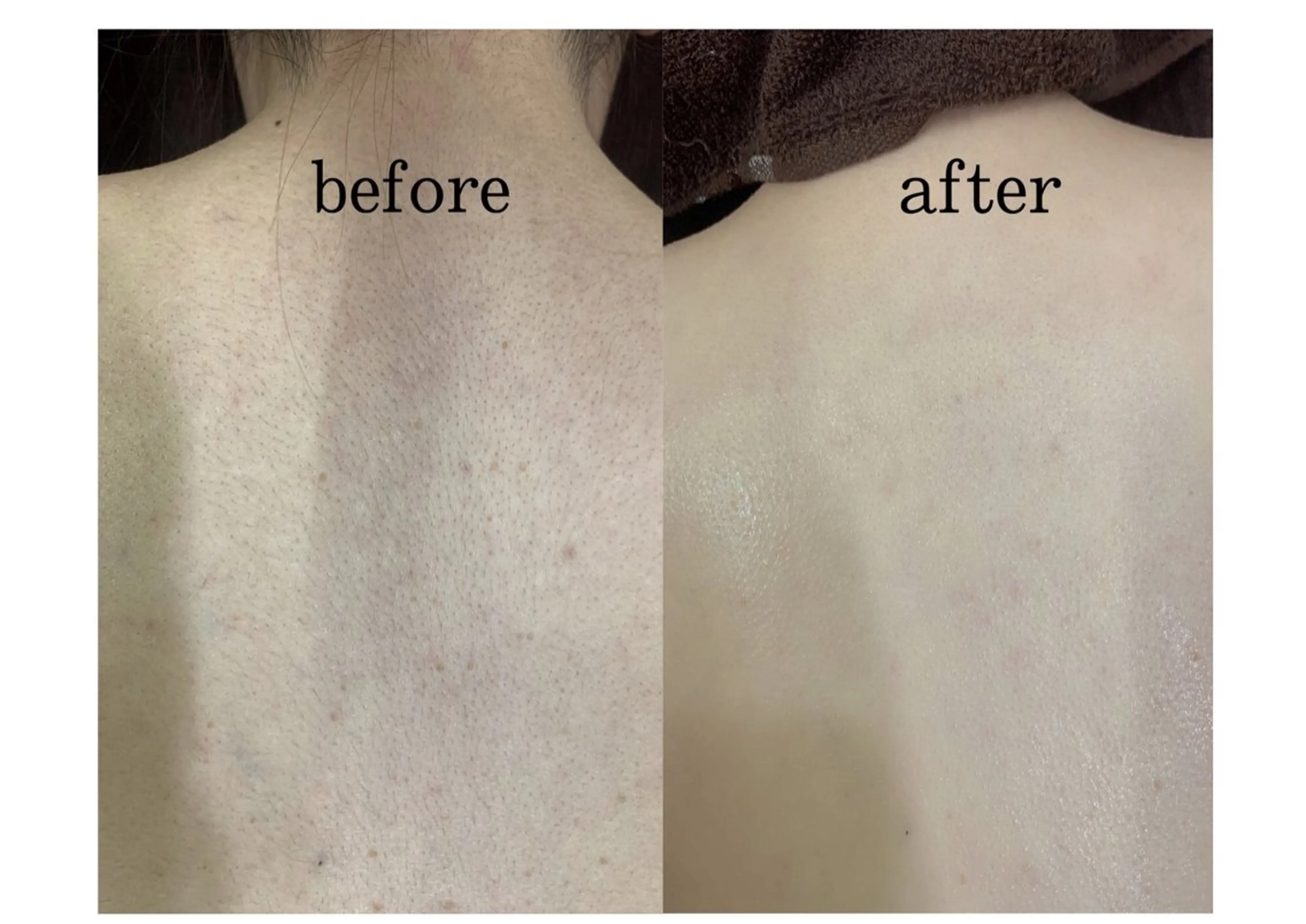 メンズ ツヤ肌脱毛サロン Grast🌿アイカのエステ・リラクイメージ