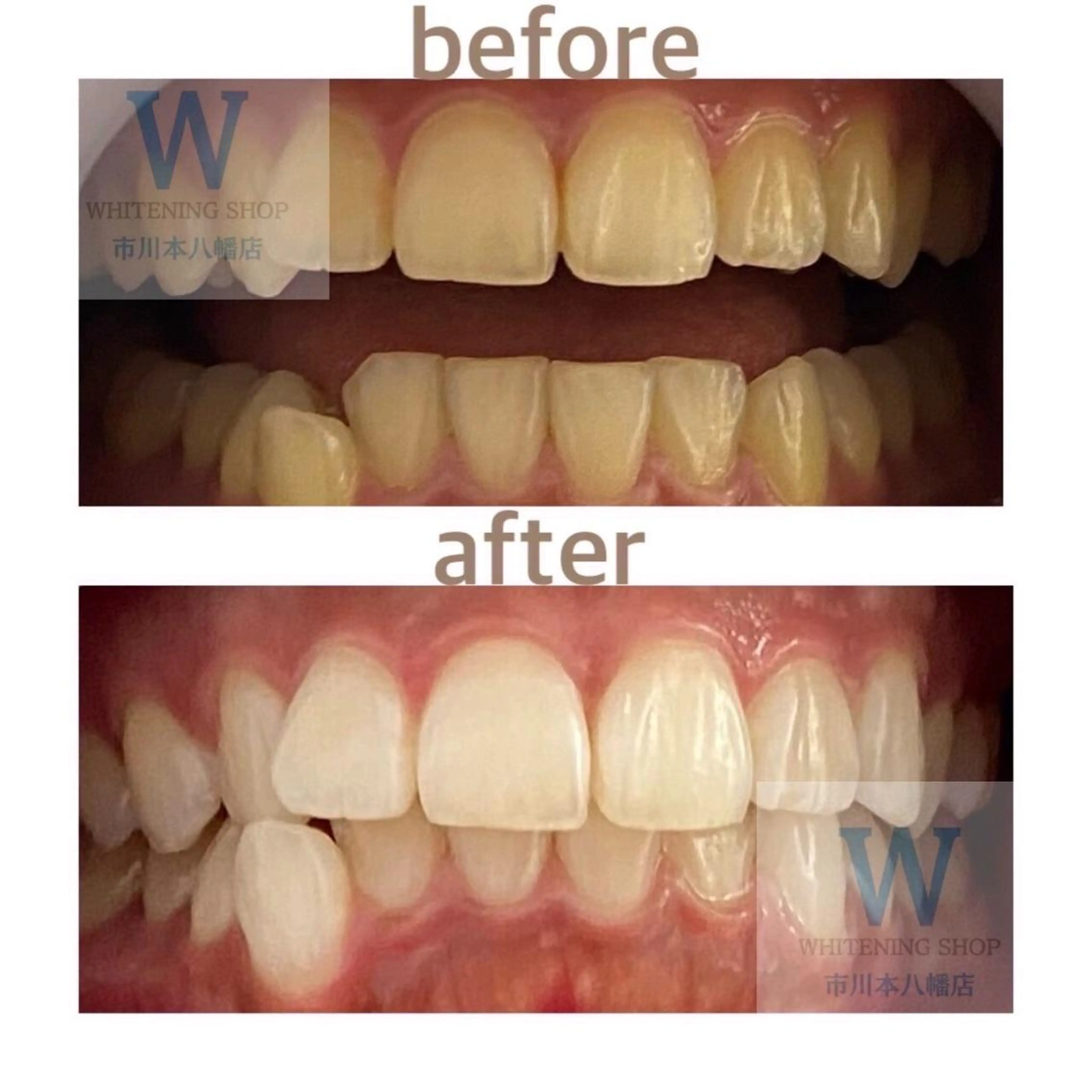 ホワイトニング ショップ本八幡店のエステ・リラクイメージ