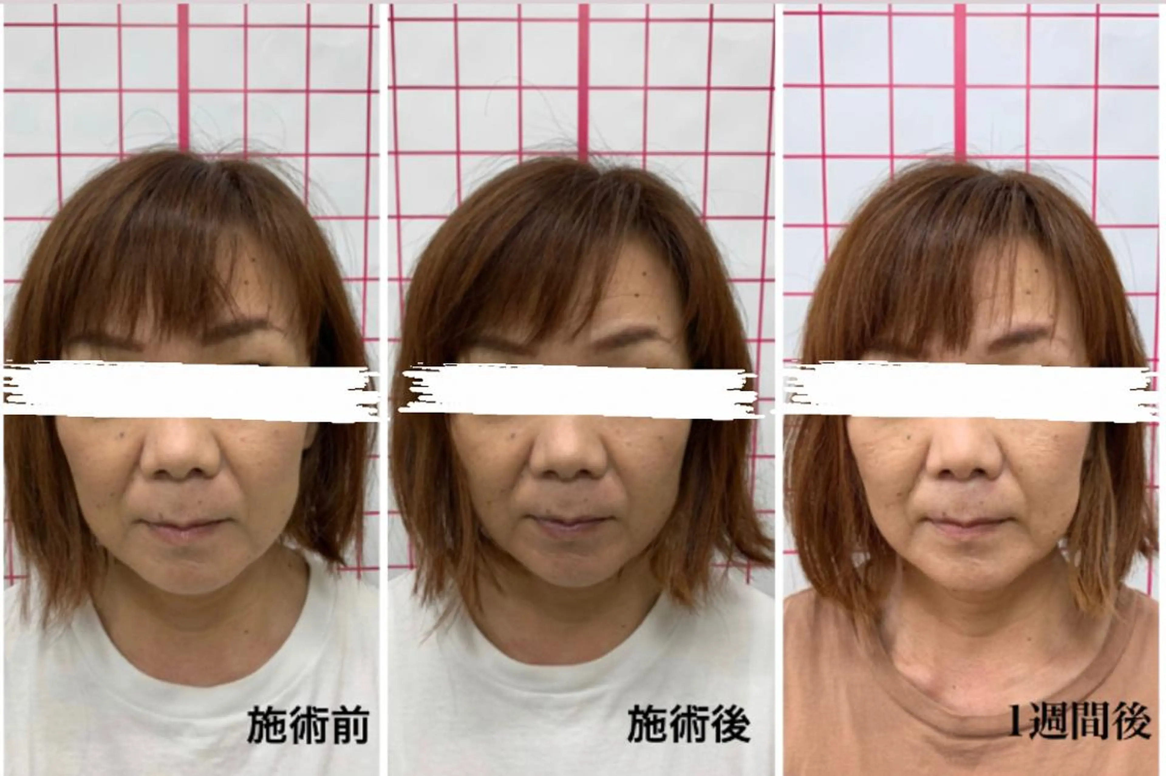 エステ リラク だいち 鍼灸院　伊伝居院のエステ・リラクイメージ