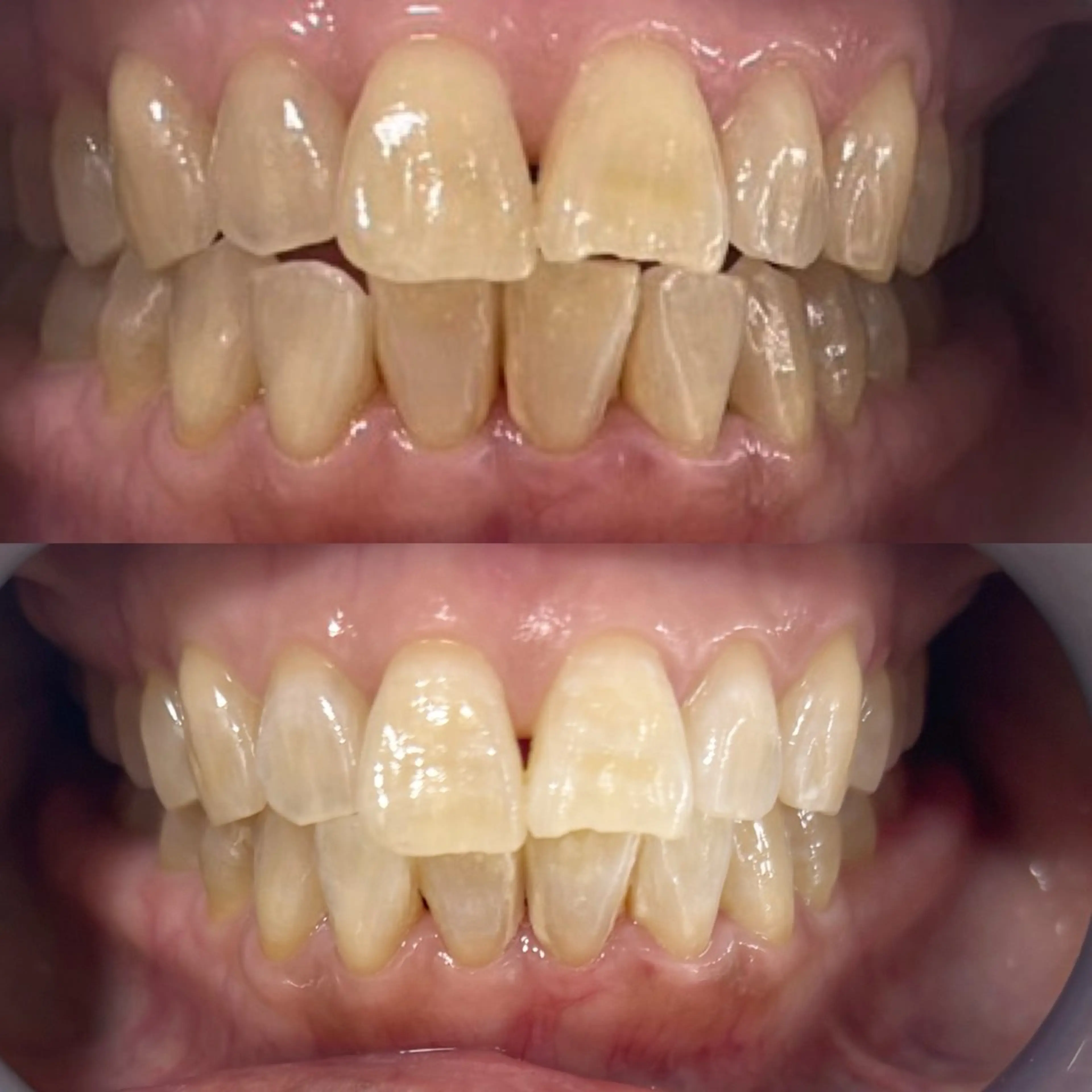 マツエク・マツパ セルフホワイトニング 耳ツボジュエリーのエステ・リラクイメージ