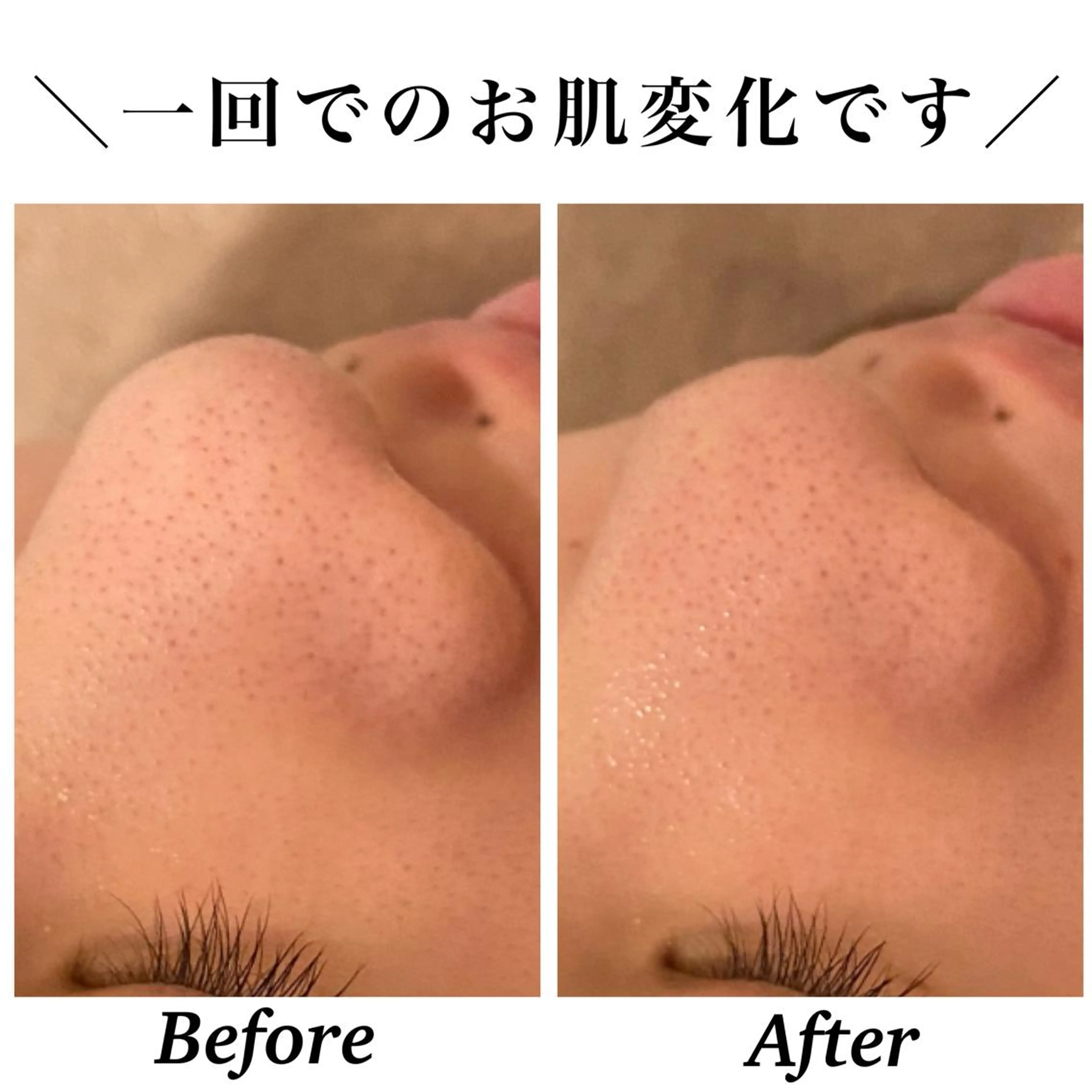 Bellesthe （ベルエステ）のエステ・リラクイメージ