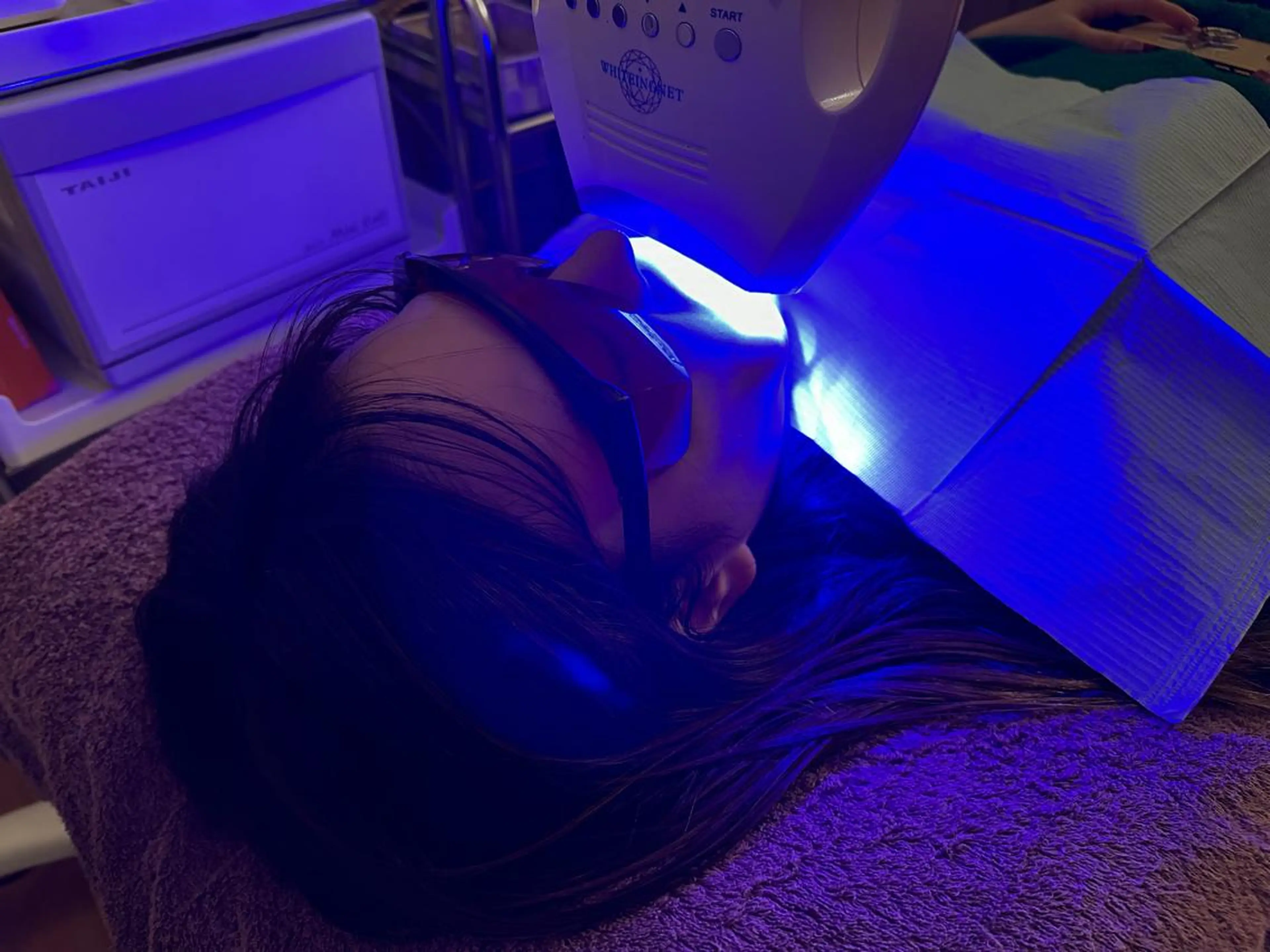 【60分集中コース】歯の黄ばみを、どうしても白くしたい方（期間限定メニュー）の写真