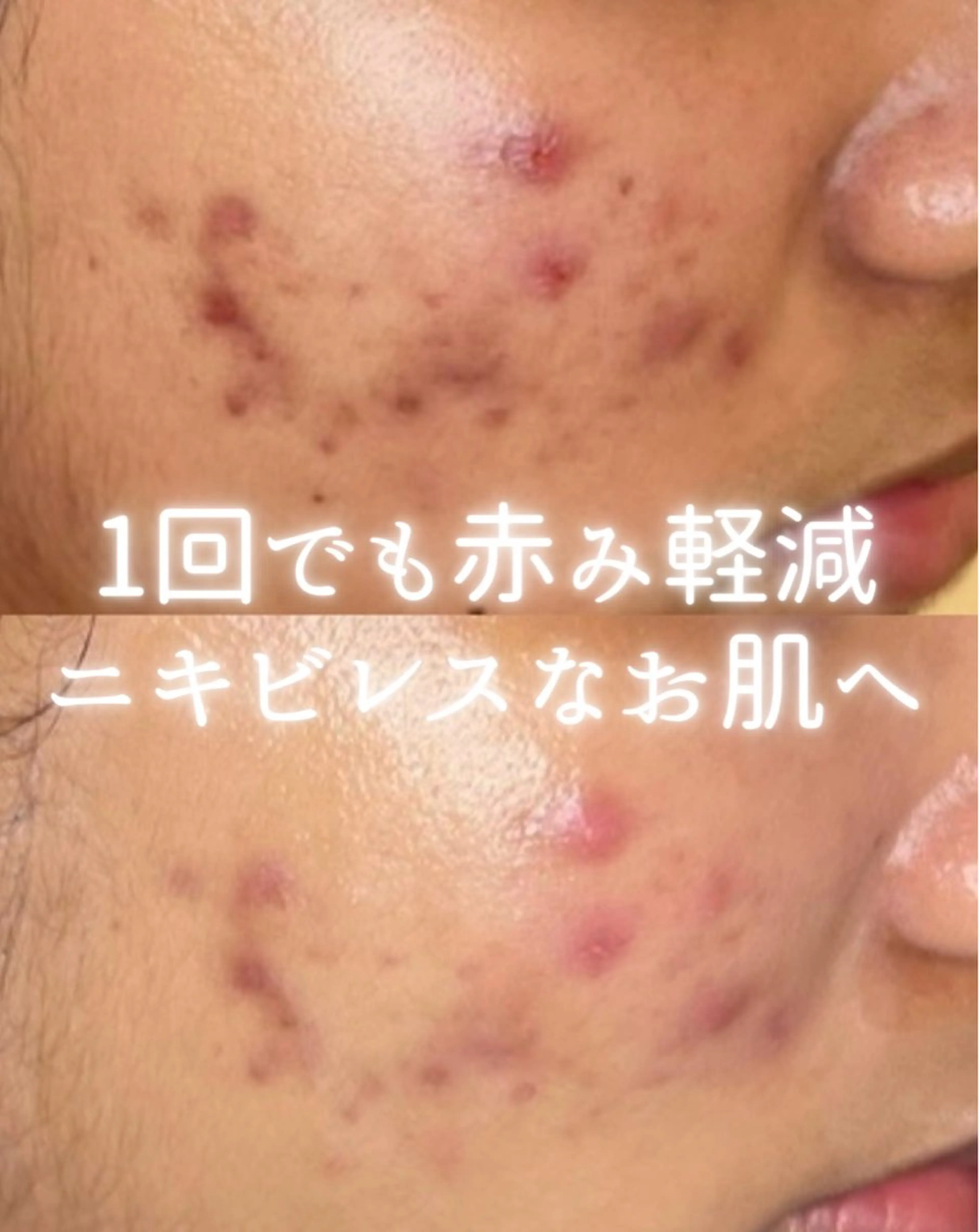 リルビー 肌育・肌質改善サロンのその他イメージ