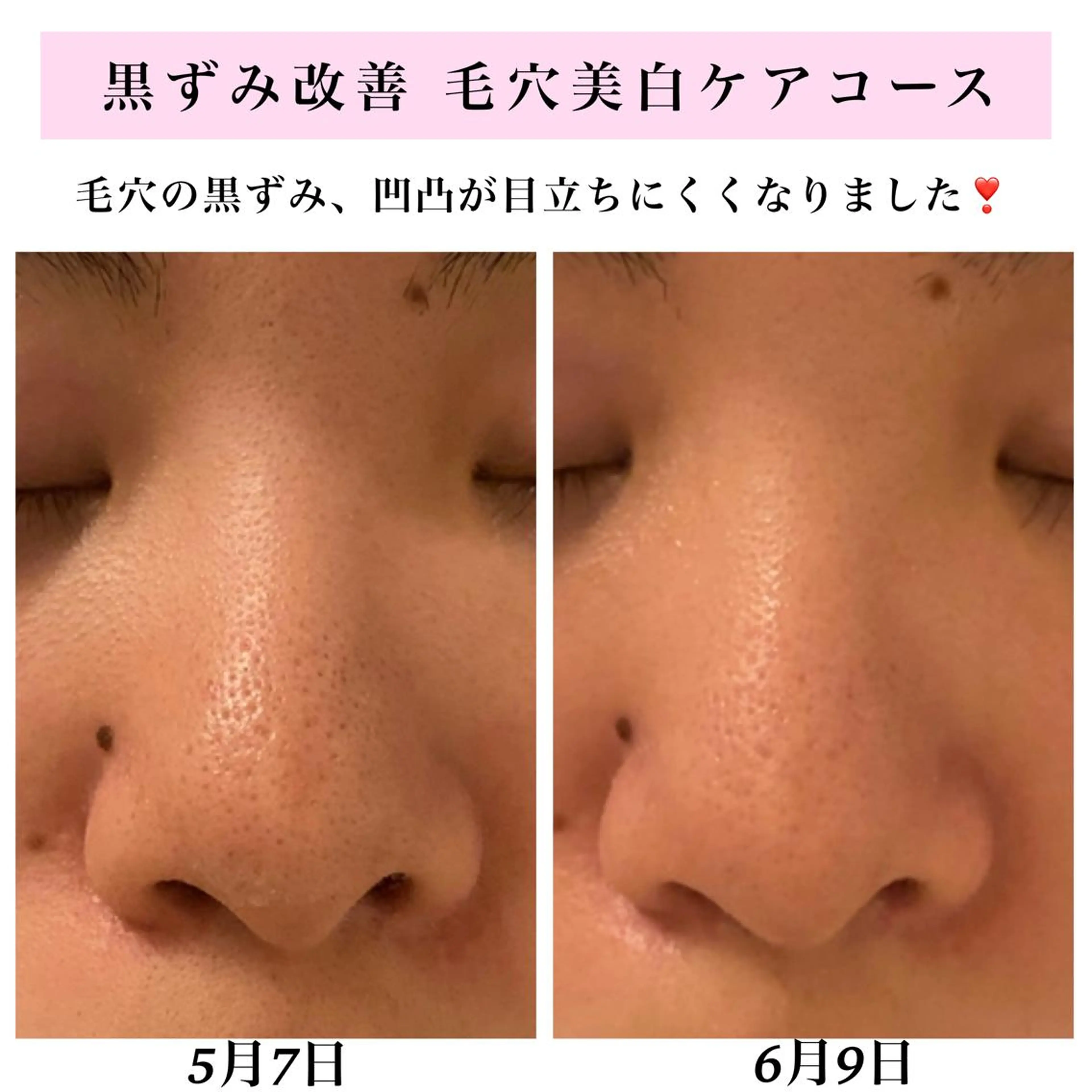 エステ リラク Bellesthe （ベルエステ）のエステ・リラクイメージ