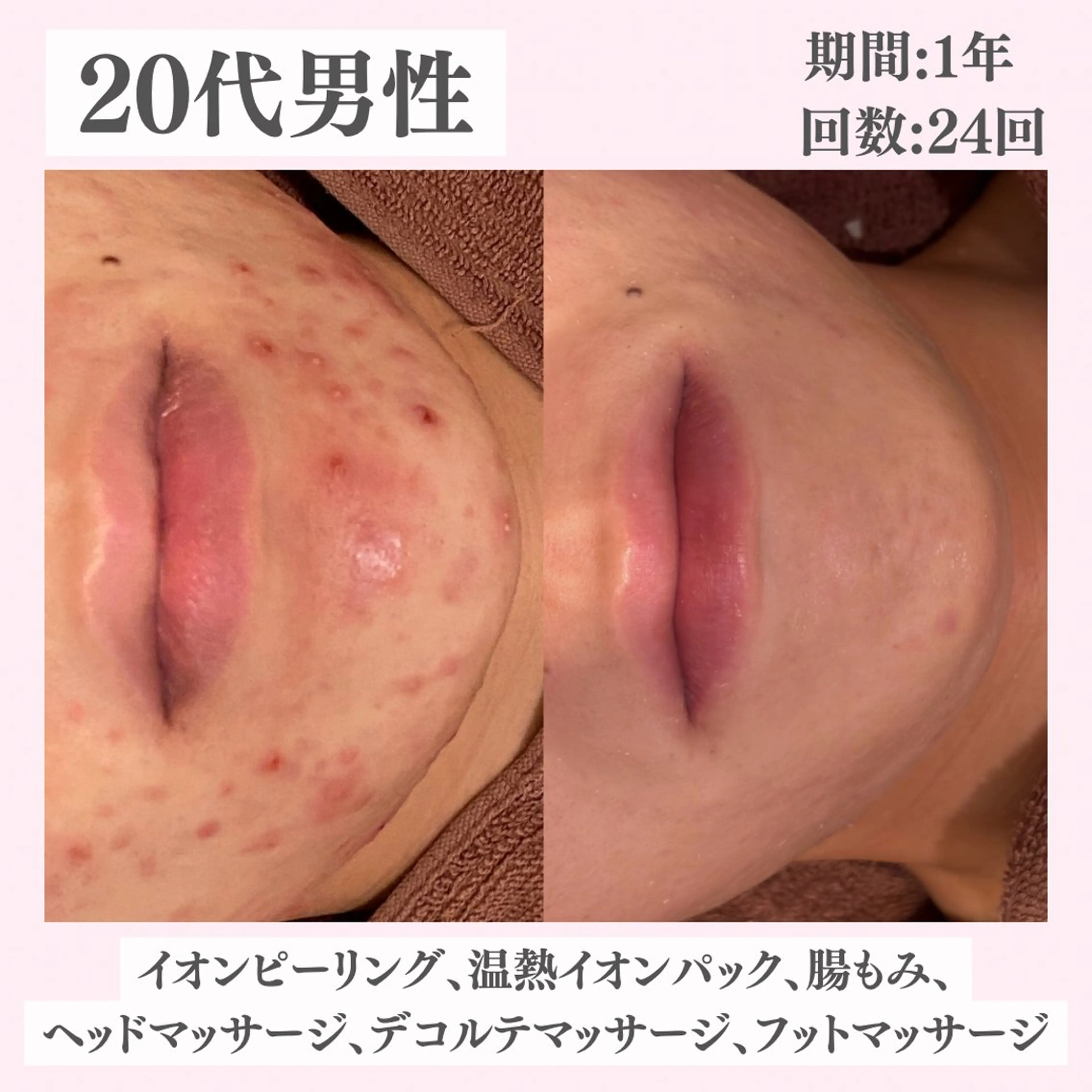 エステ リラク ニキビ・肌質改善専門 ♡人生が変わるサロンのエステ・リラクイメージ