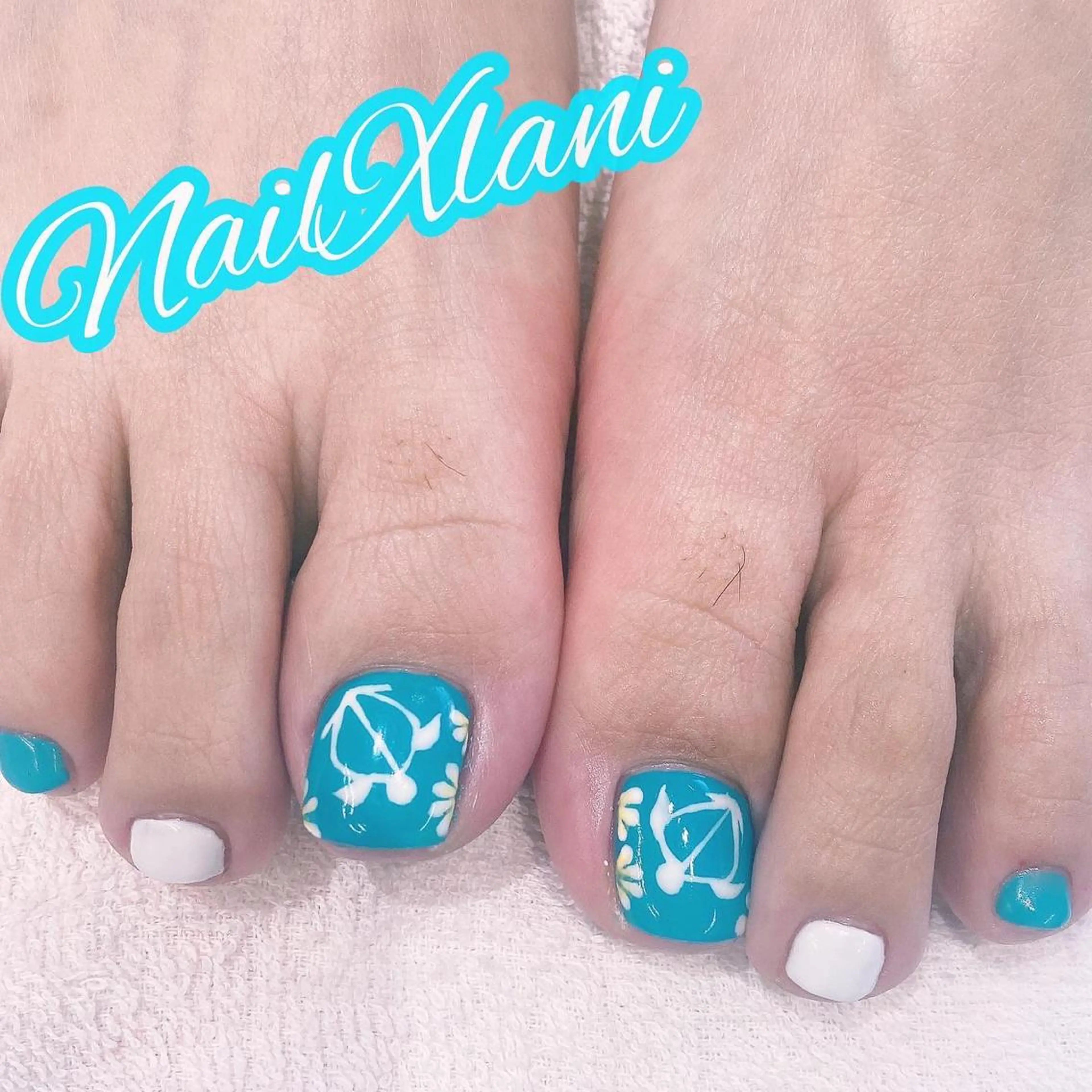 ネイル Nail×Lani 深爪矯正対応◎のネイルデザイン