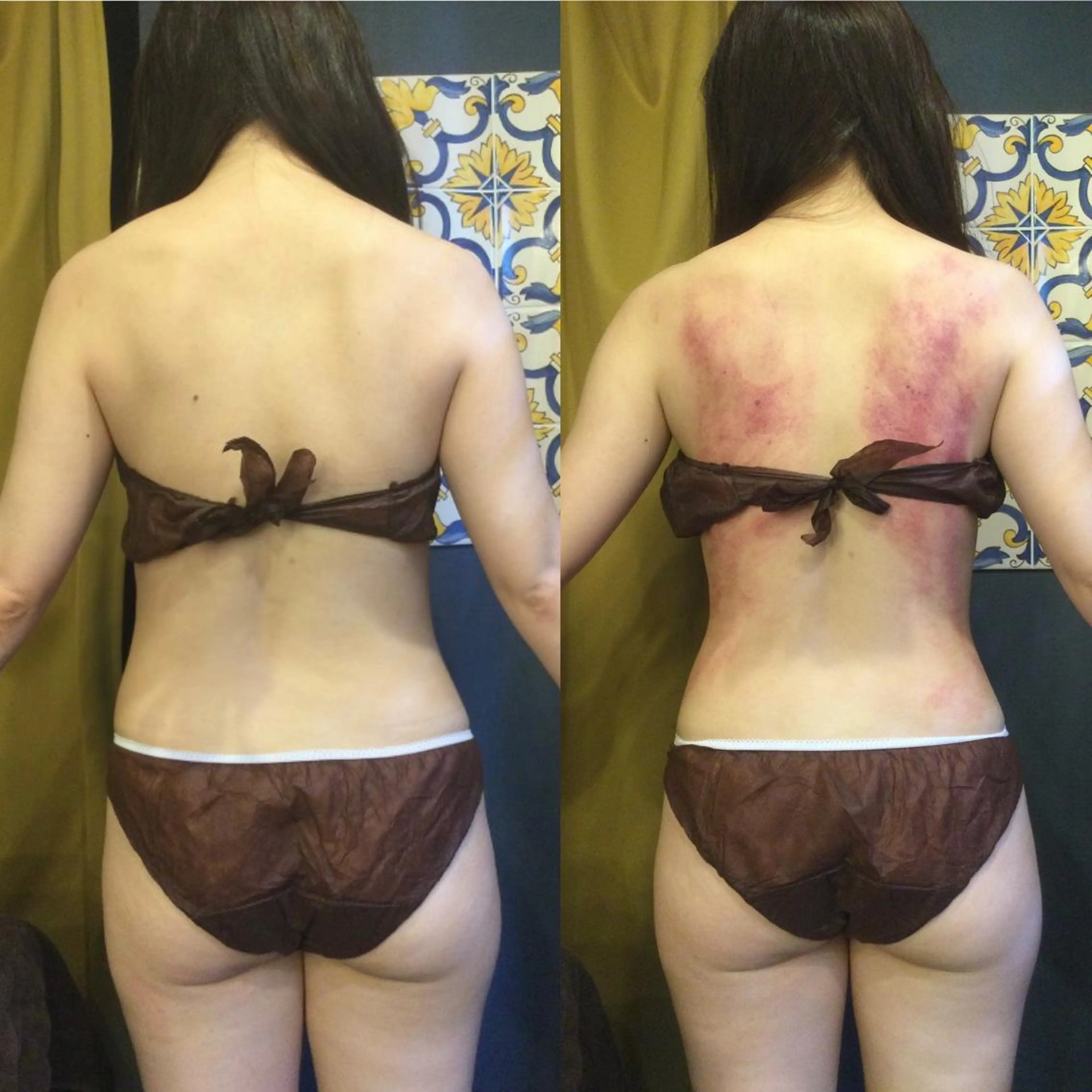 その他 小顔やたるみに特化 💚野瀬可蓮のその他イメージ