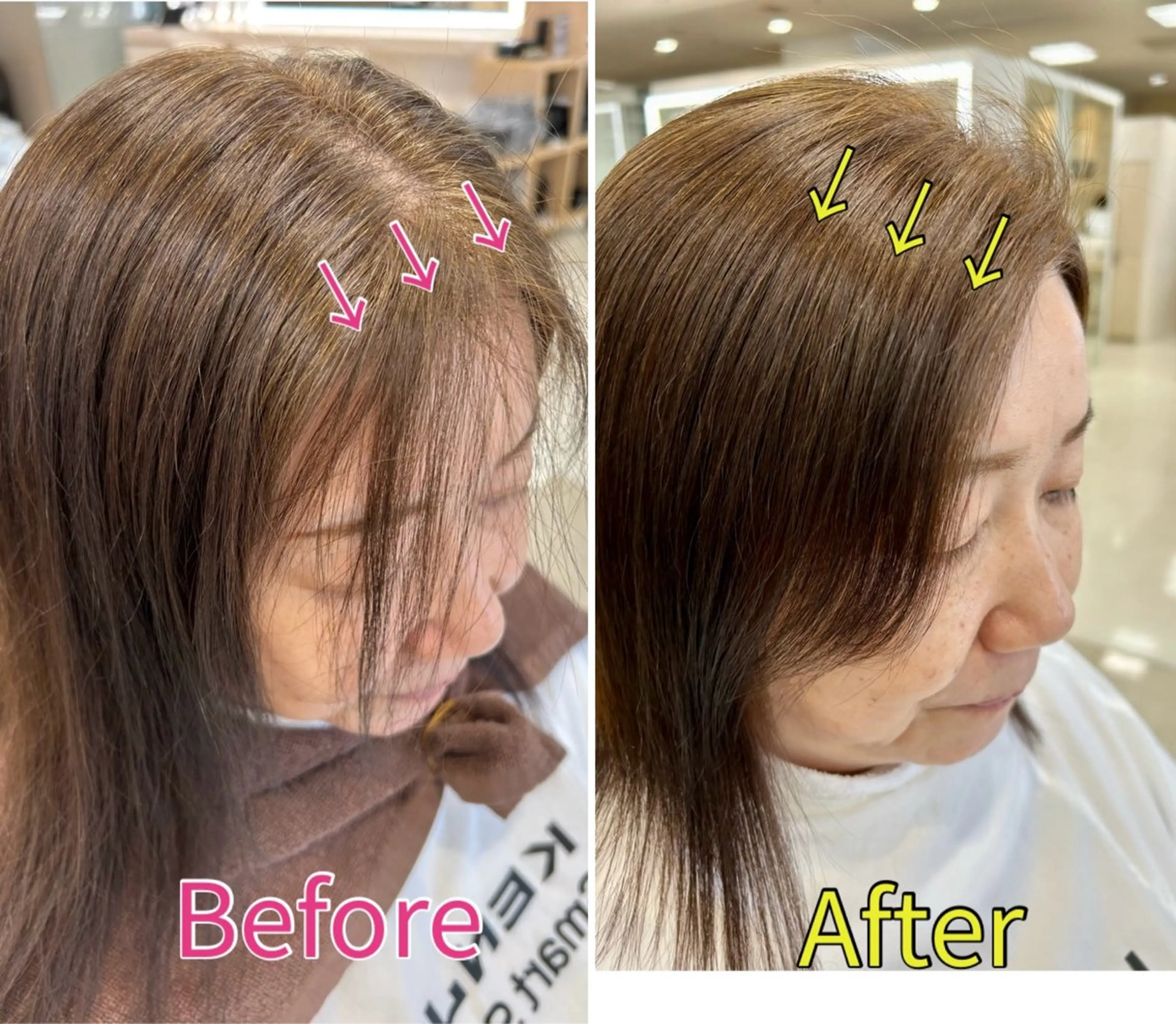 『カウンセリング、シャンプー、ブロー、エンジェリックケア』生え癖悩みの方必見！の写真