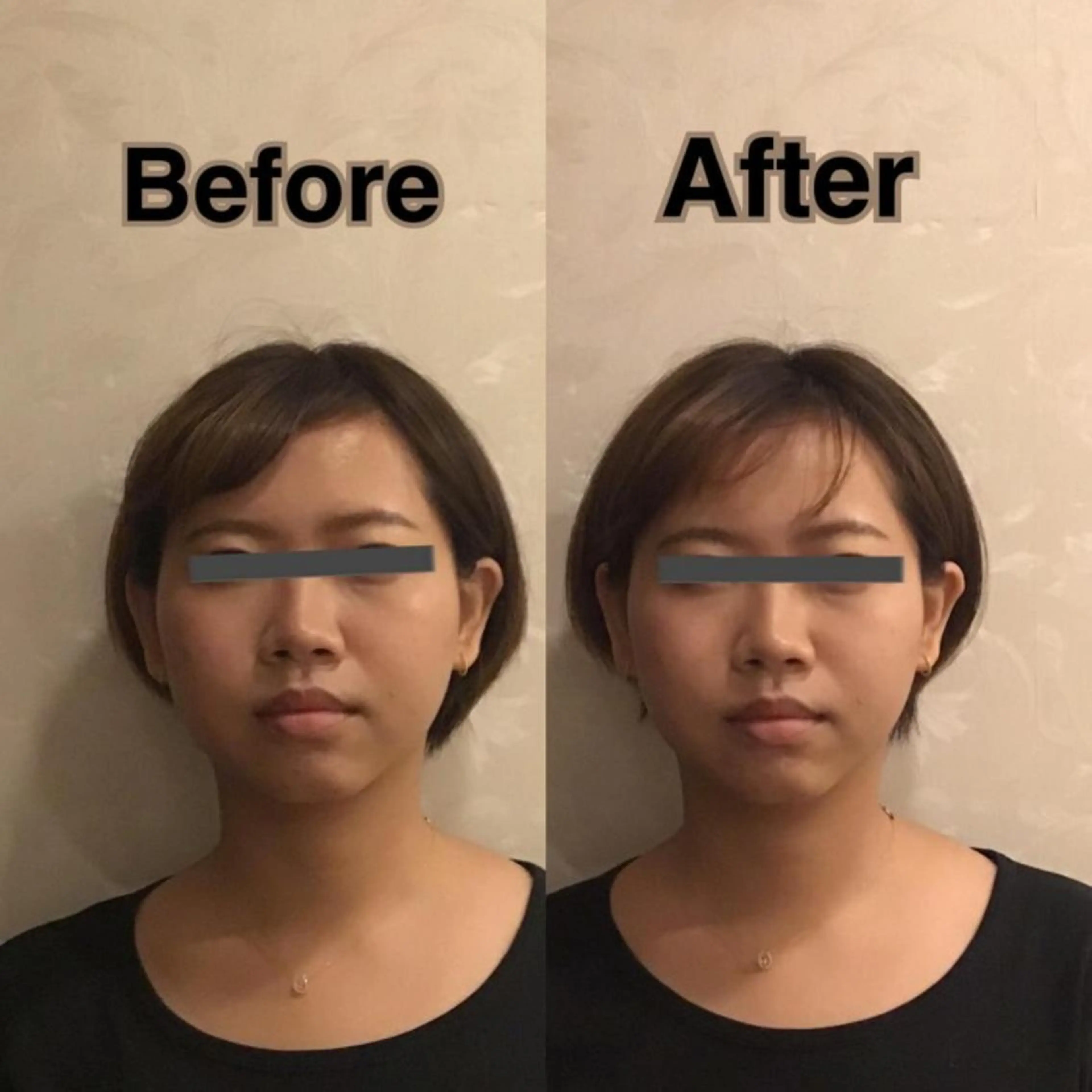 姿勢・骨盤/小顔矯正 痩身ダイエット 横田のエステ・リラクイメージ