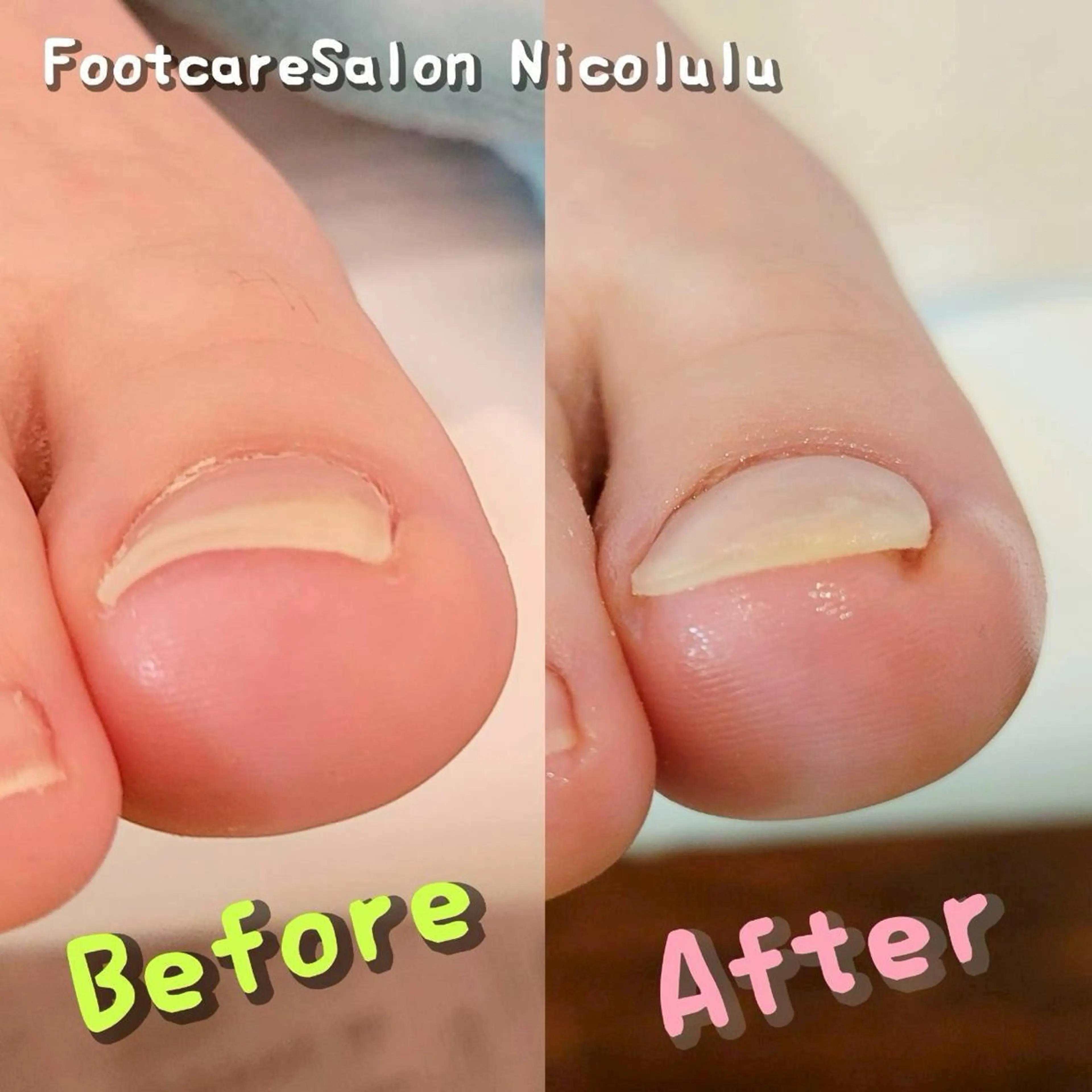 リラク 足トラブル専門 ニコルル金沢のエステ・リラクイメージ