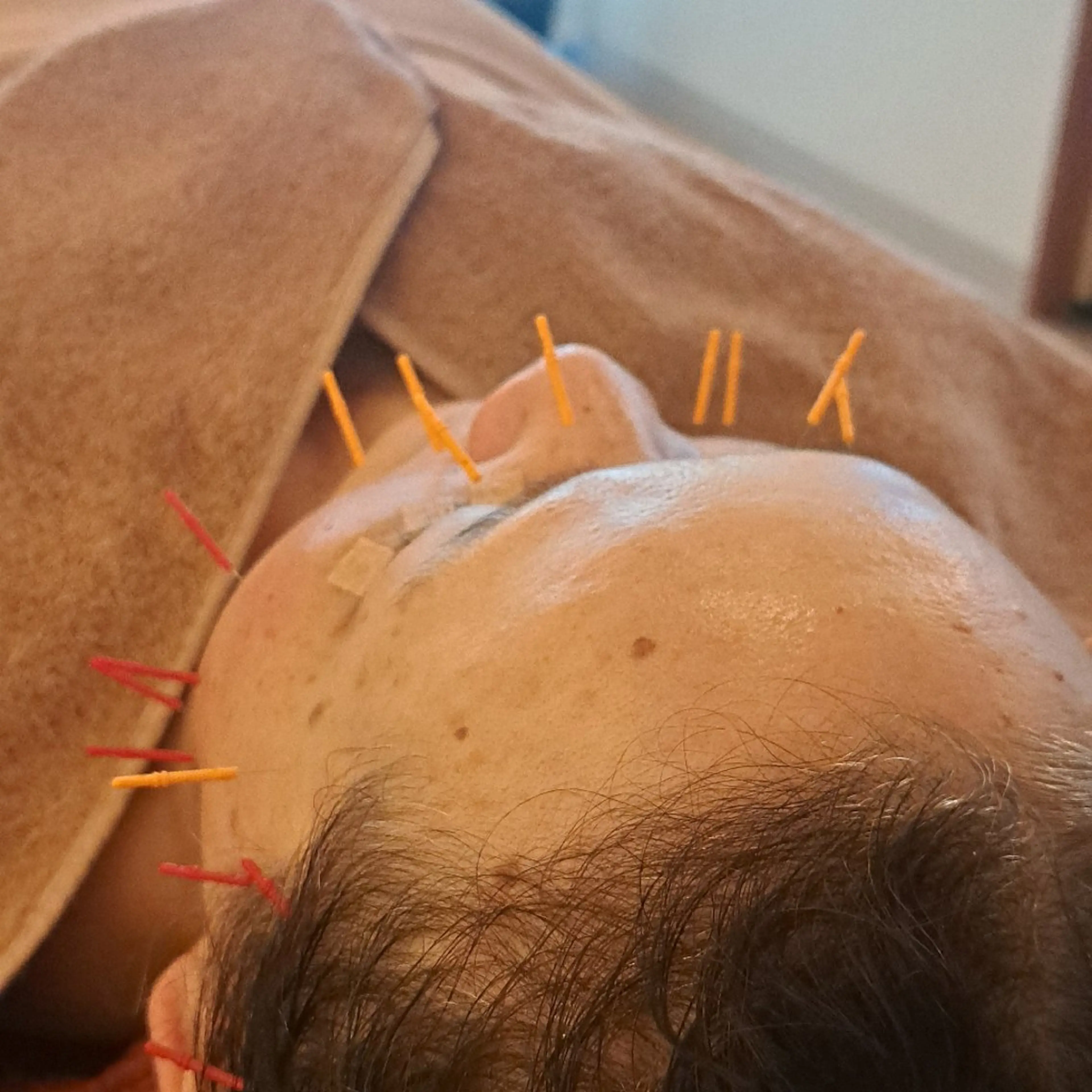 エステ リラク 美容鍼×エステ　鍼灸 サロンmiyabiのエステ・リラクイメージ