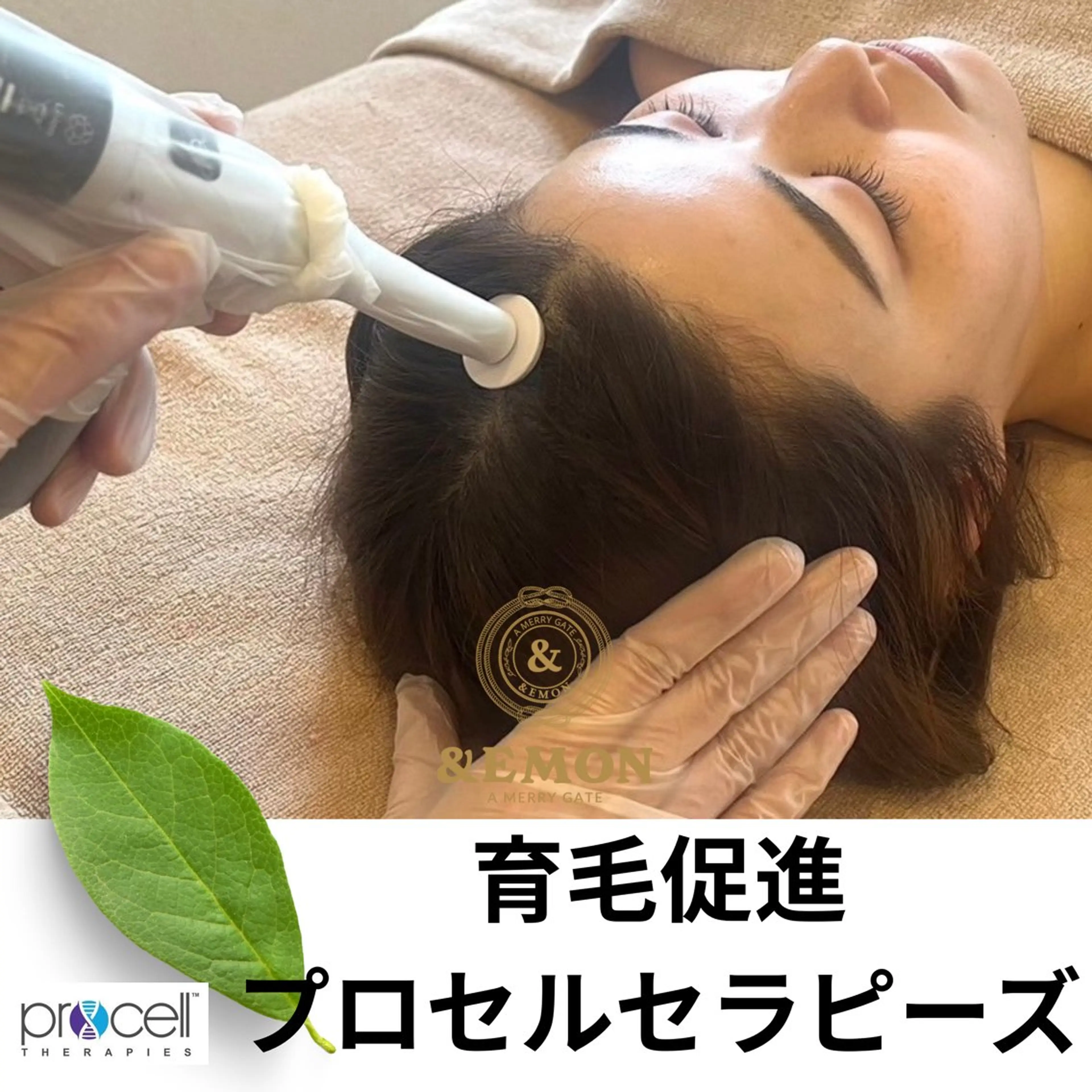 体験◎【分け目・生え際・M字・円形悩みに】育毛促進プロセルセラピーズ体験の写真