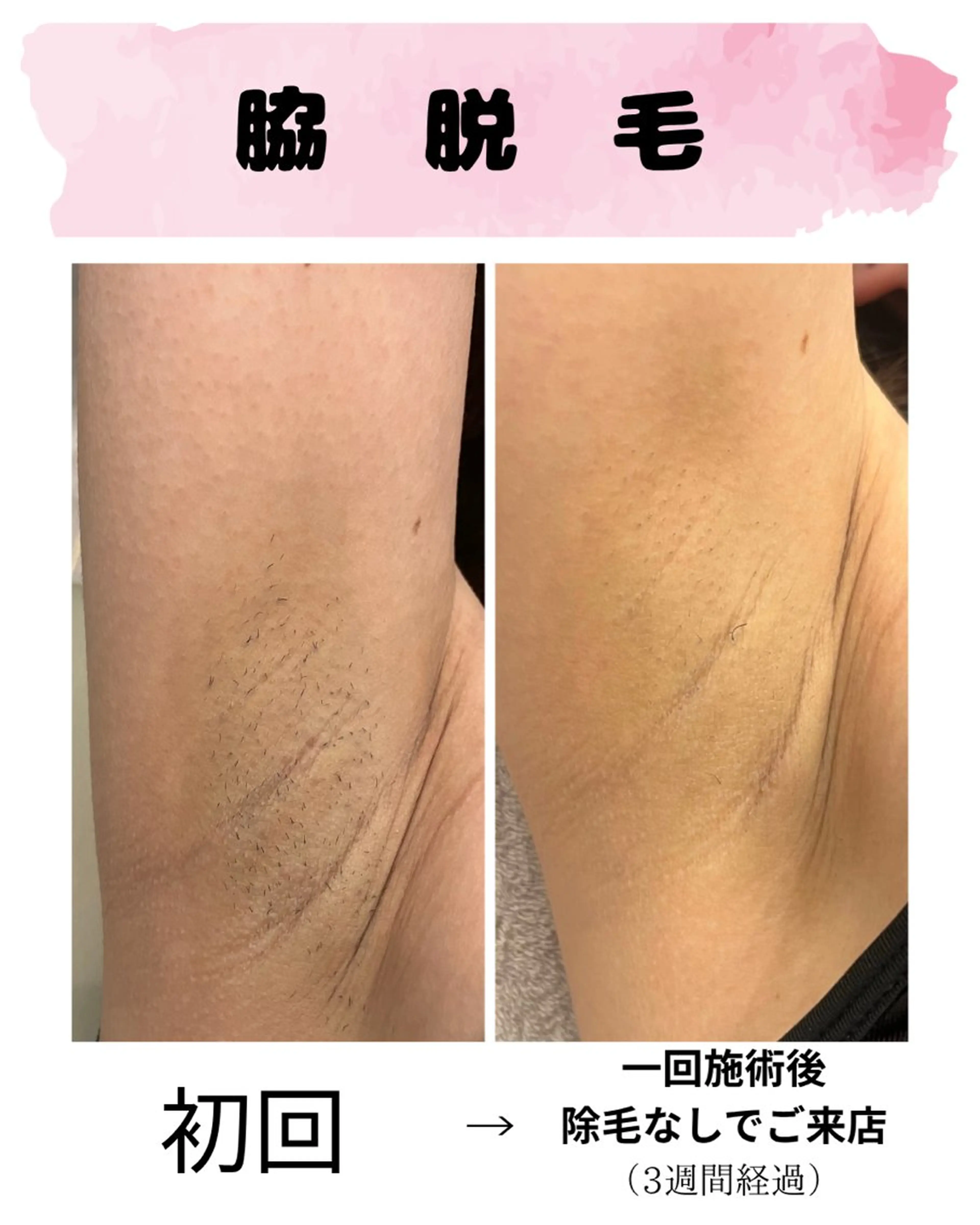 脱毛 Infinity -Kayo-のエステ・リラクイメージ