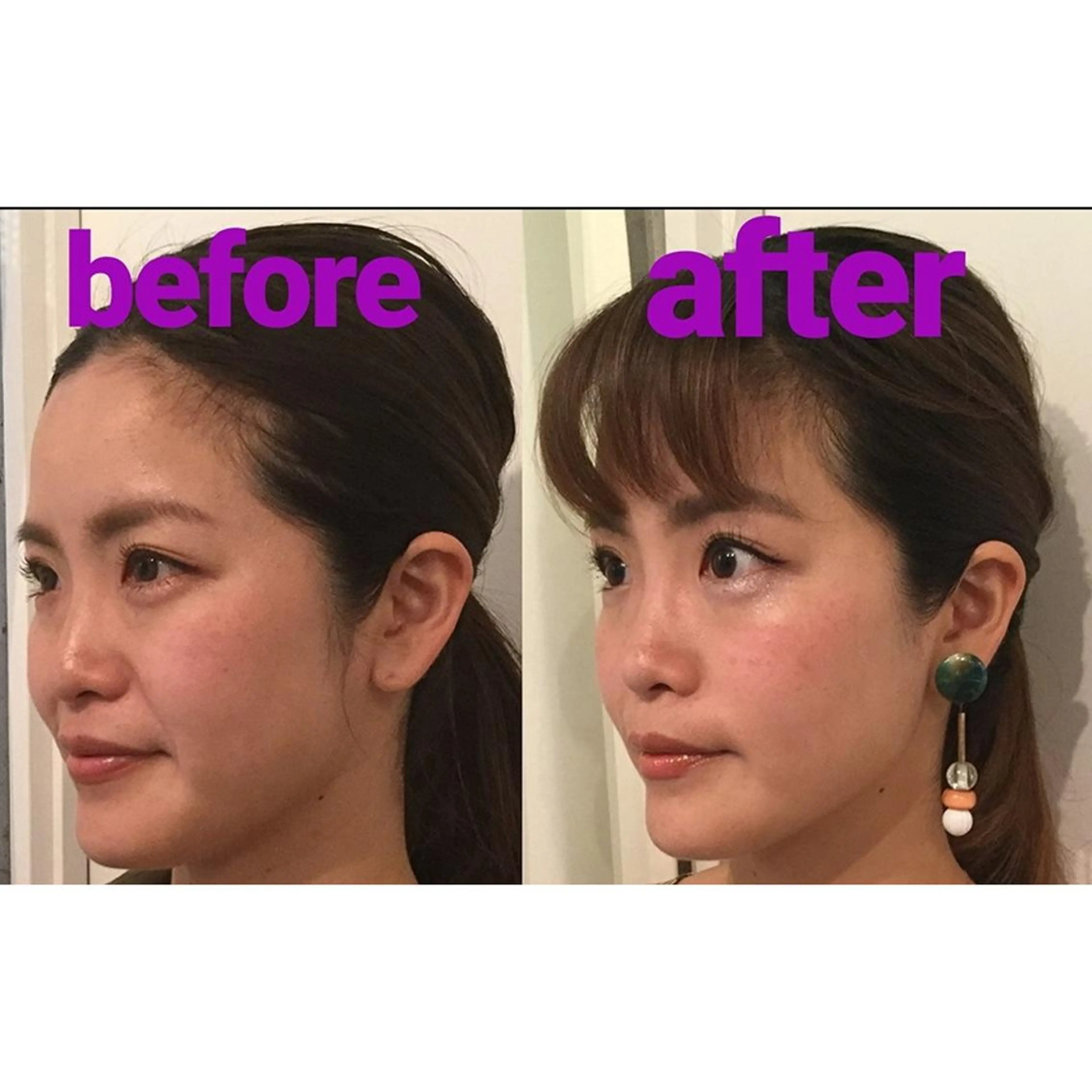 隆鼻矯正専門店ラプリ 古越のエステ・リラクイメージ