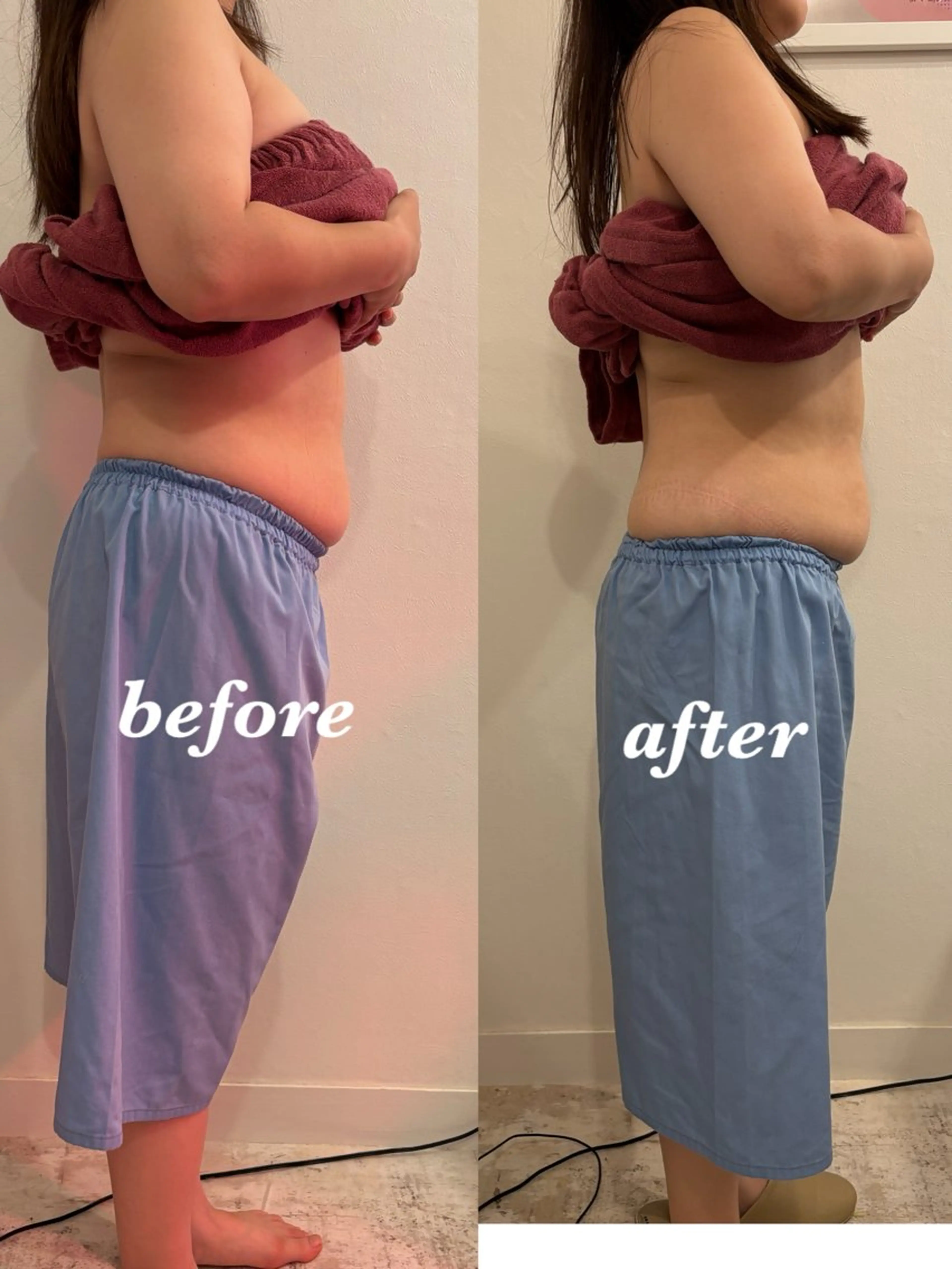 腸活サポート みなみののエステ・リラクイメージ