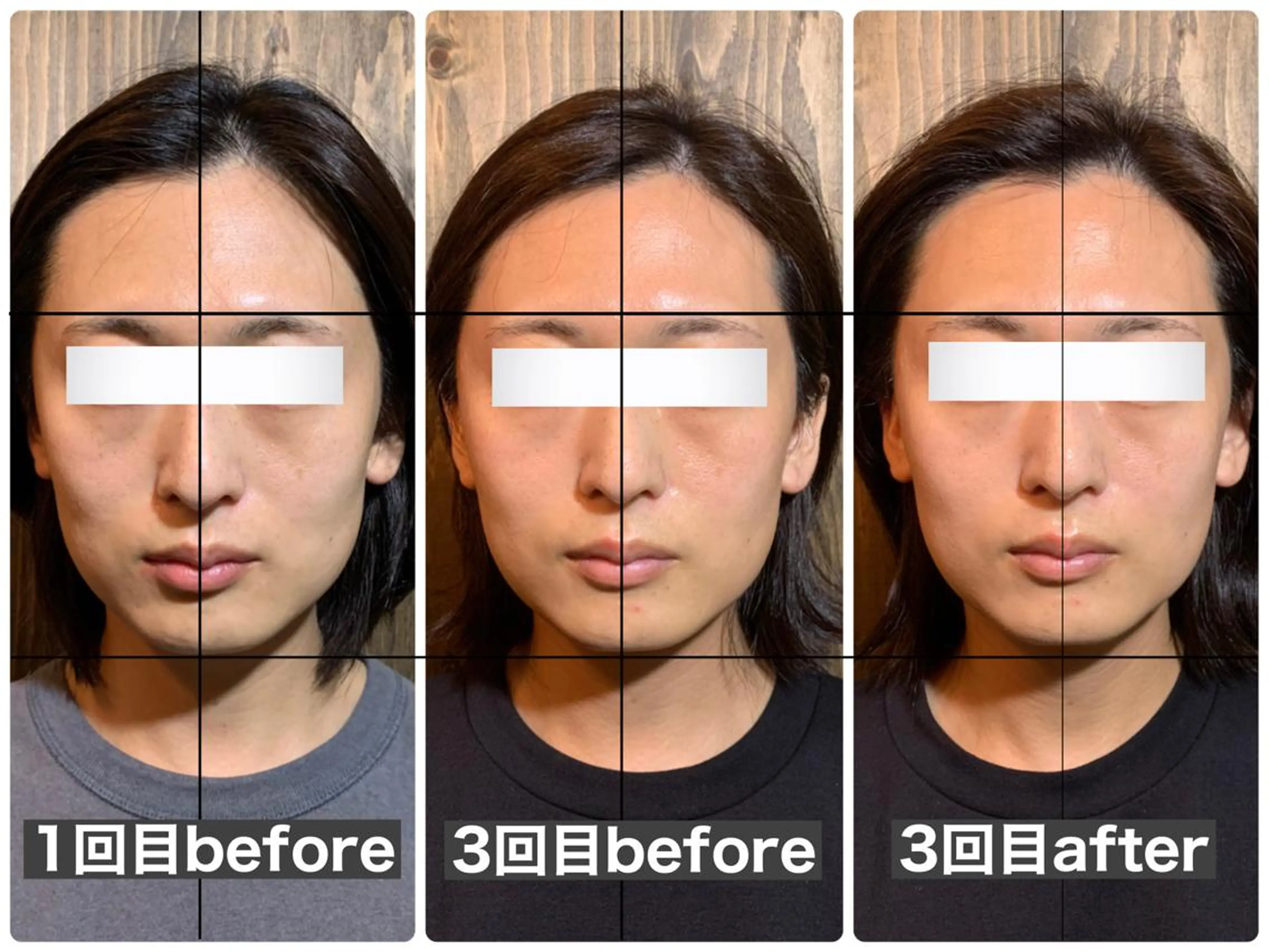 エステ リラク 💎後悔させない小顔 矯正💎イトヤマ🌱のエステ・リラクイメージ