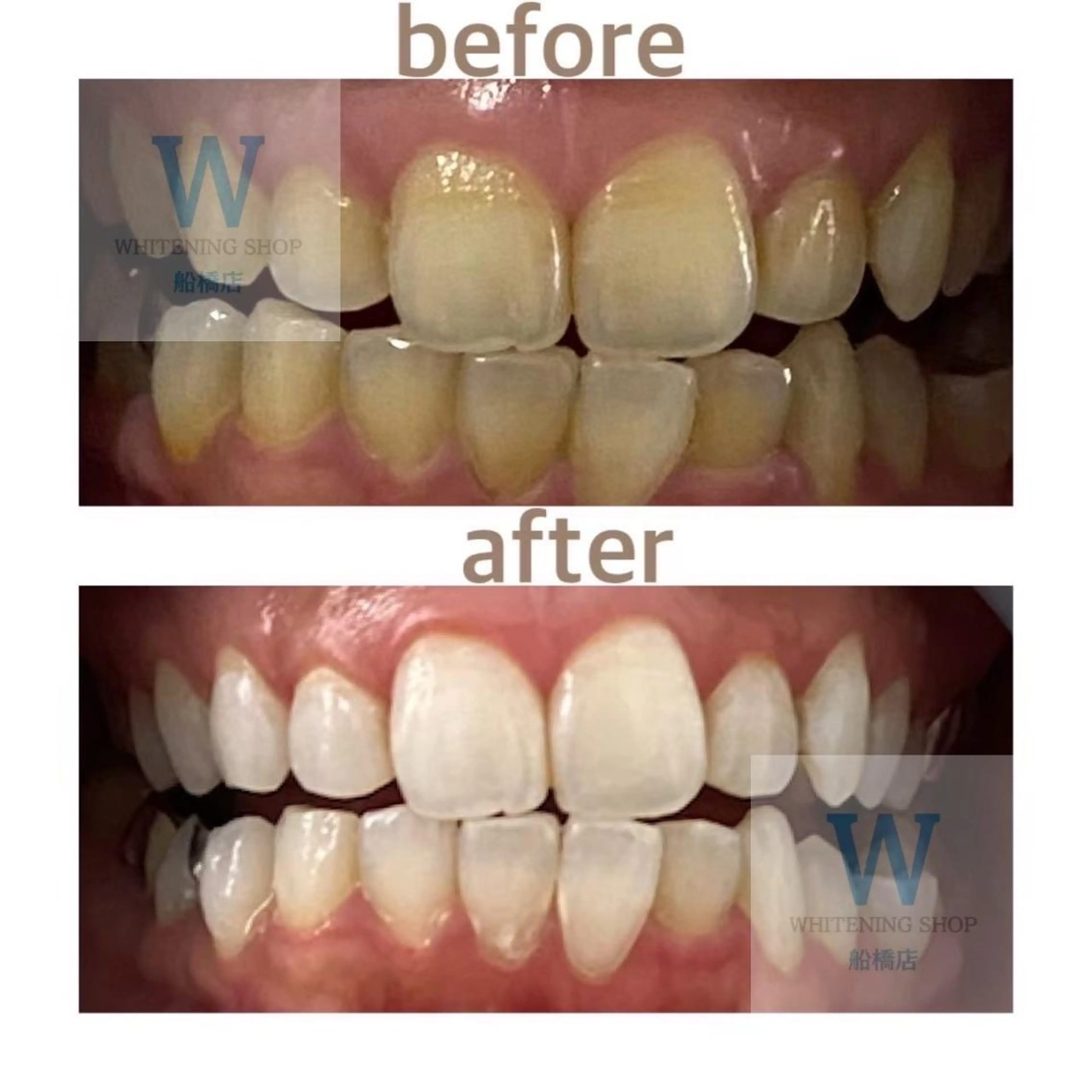 エステ リラク ホワイトニング ショップ船橋店🦷のエステ・リラクイメージ