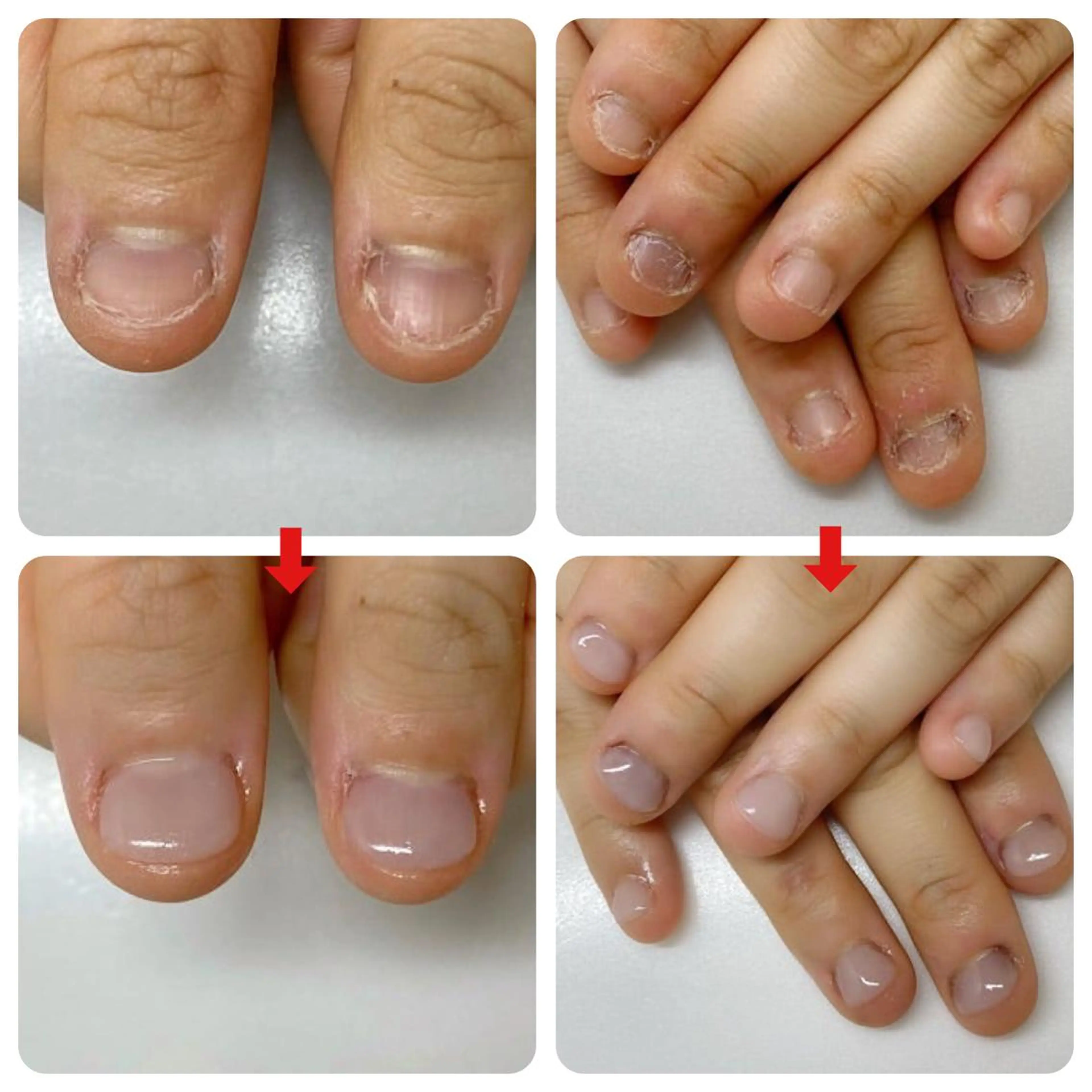 ネイル ネイルサロン アリュームのネイルデザイン