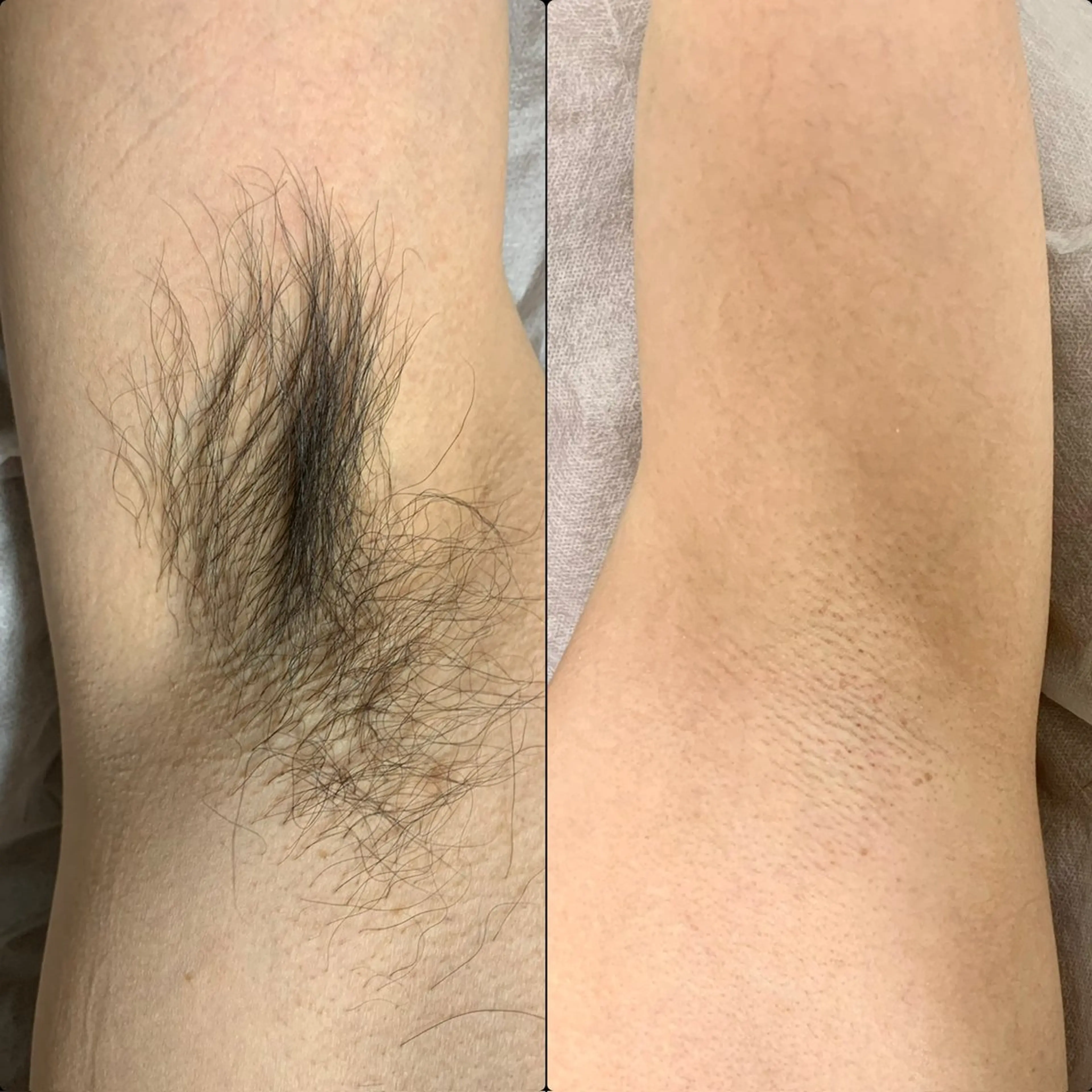 脱毛 六本木脱毛andS 店長Sachiのエステ・リラクイメージ