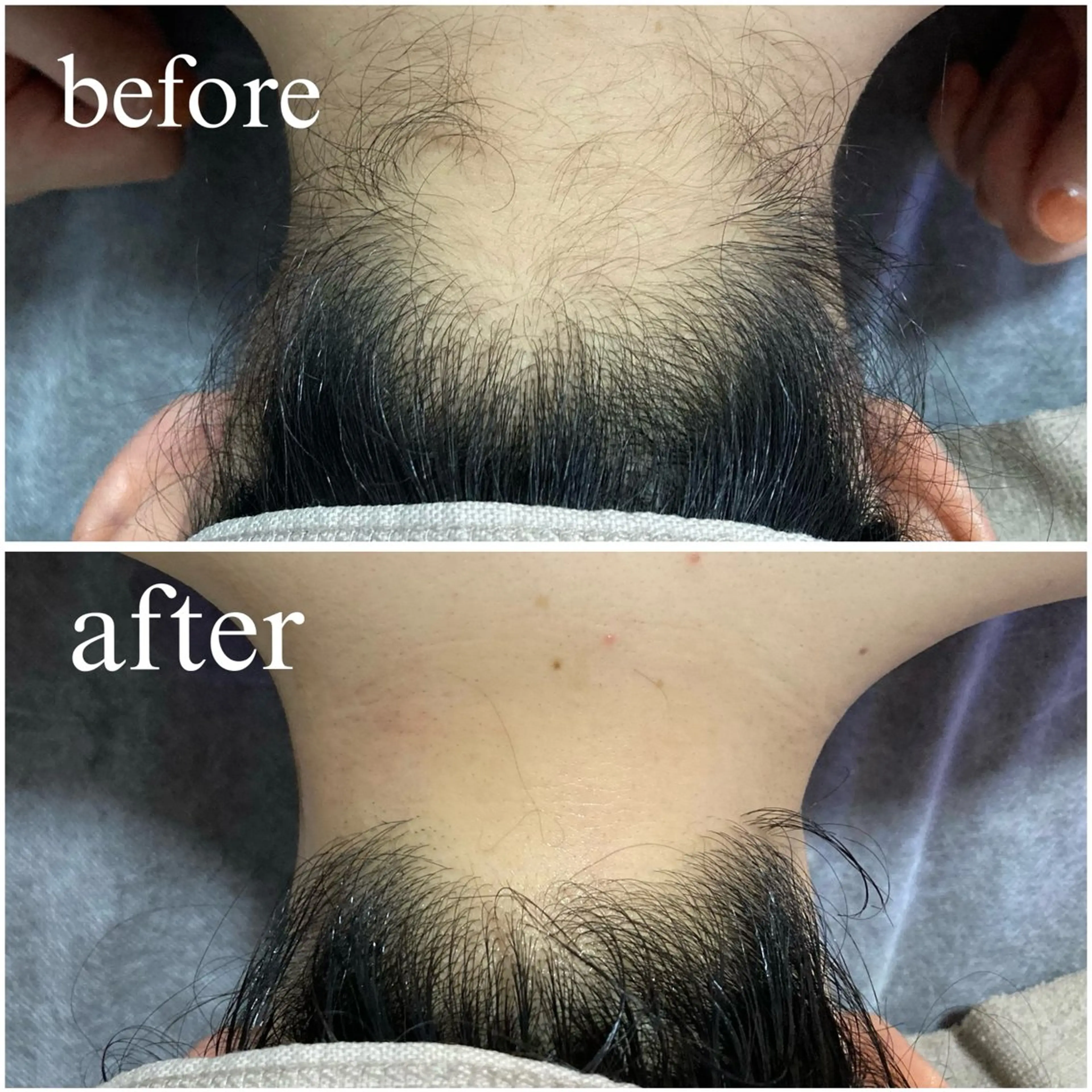 【韓国肌管理・脱毛】 クレセントのその他イメージ