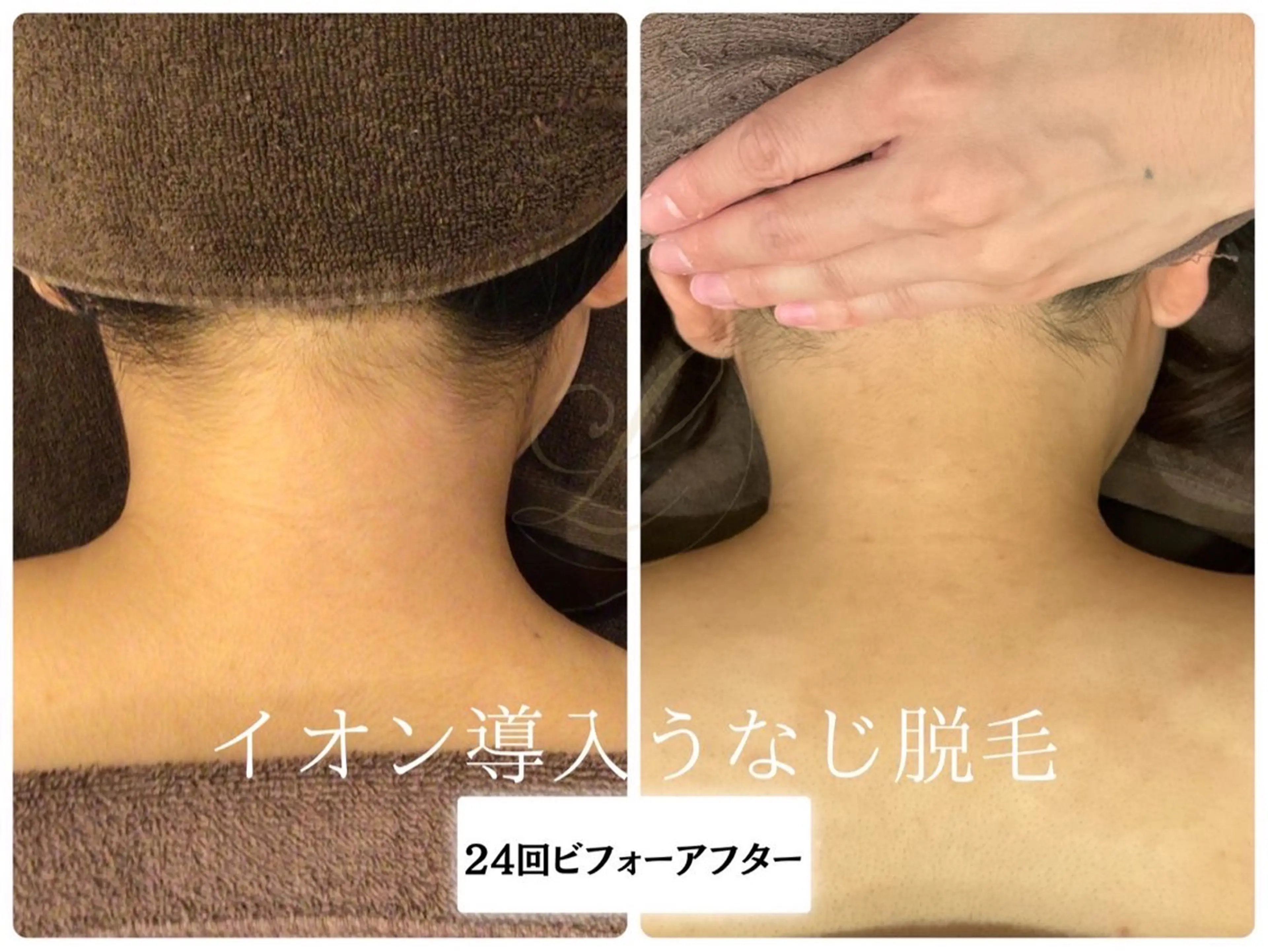 脱毛 🎀うなじ脱毛🎀 ㅣLino堀江のエステ・リラクイメージ