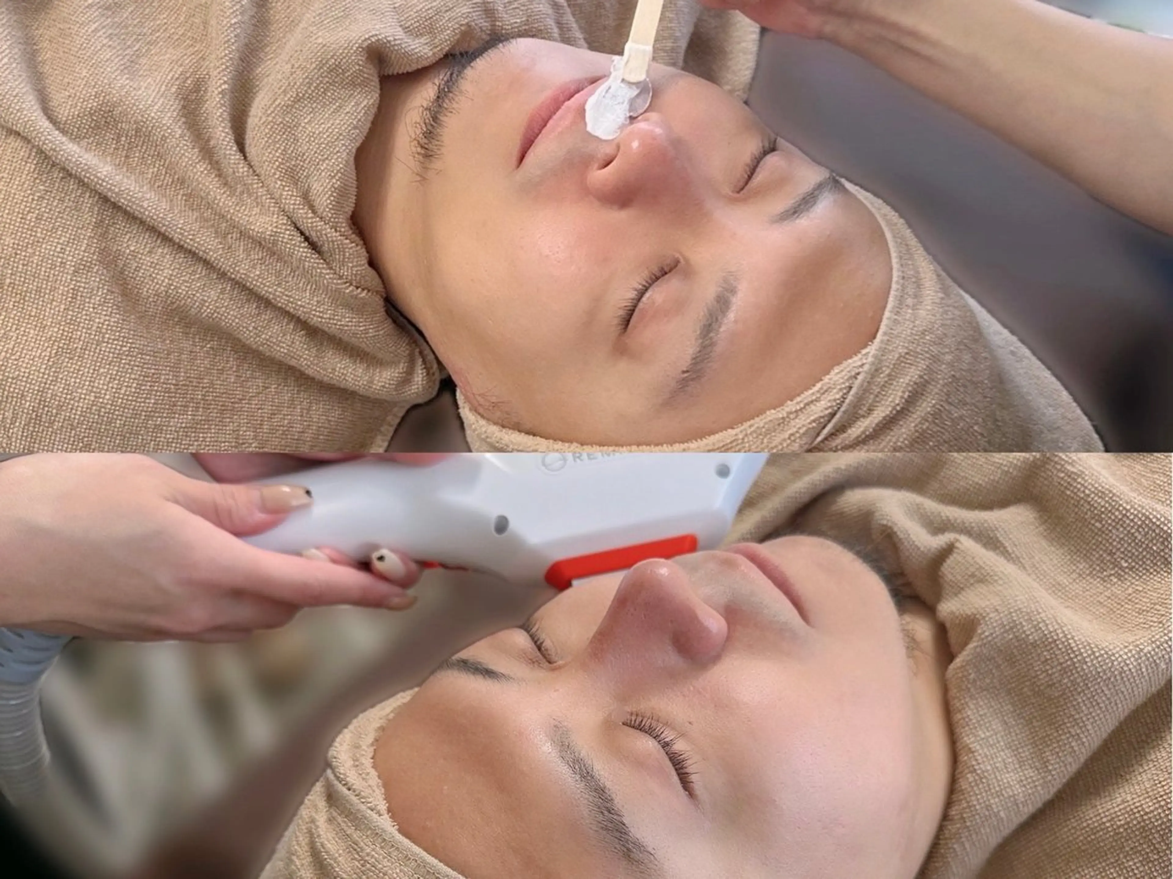 メンズ 脱毛/韓国肌管理 Epina 横浜店のその他イメージ