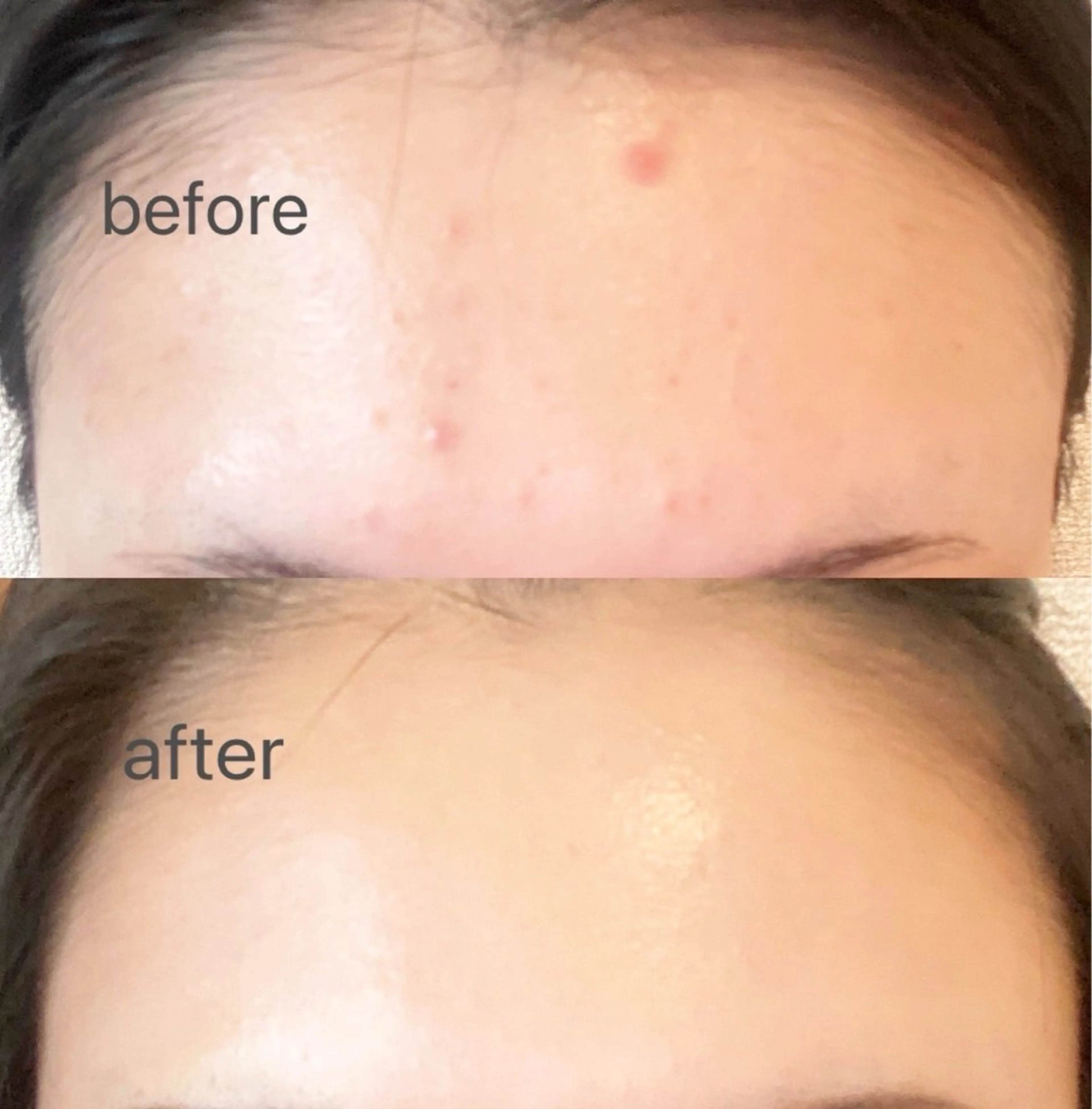 エステ Rie ×MiELのエステ・リラクイメージ